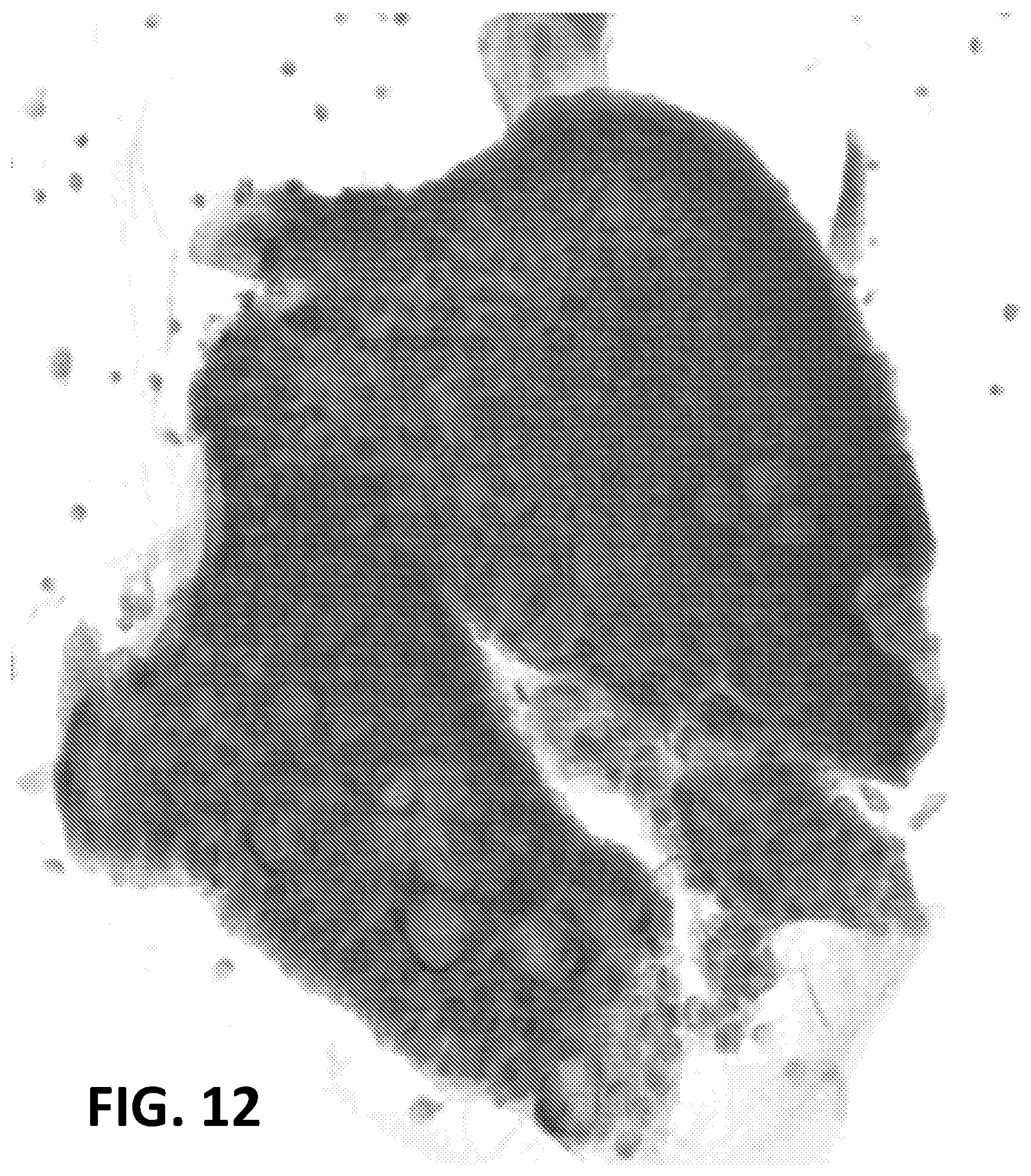 Patent US11810280 Figure 10 – Enhanced extended depth of focusing on biological samples