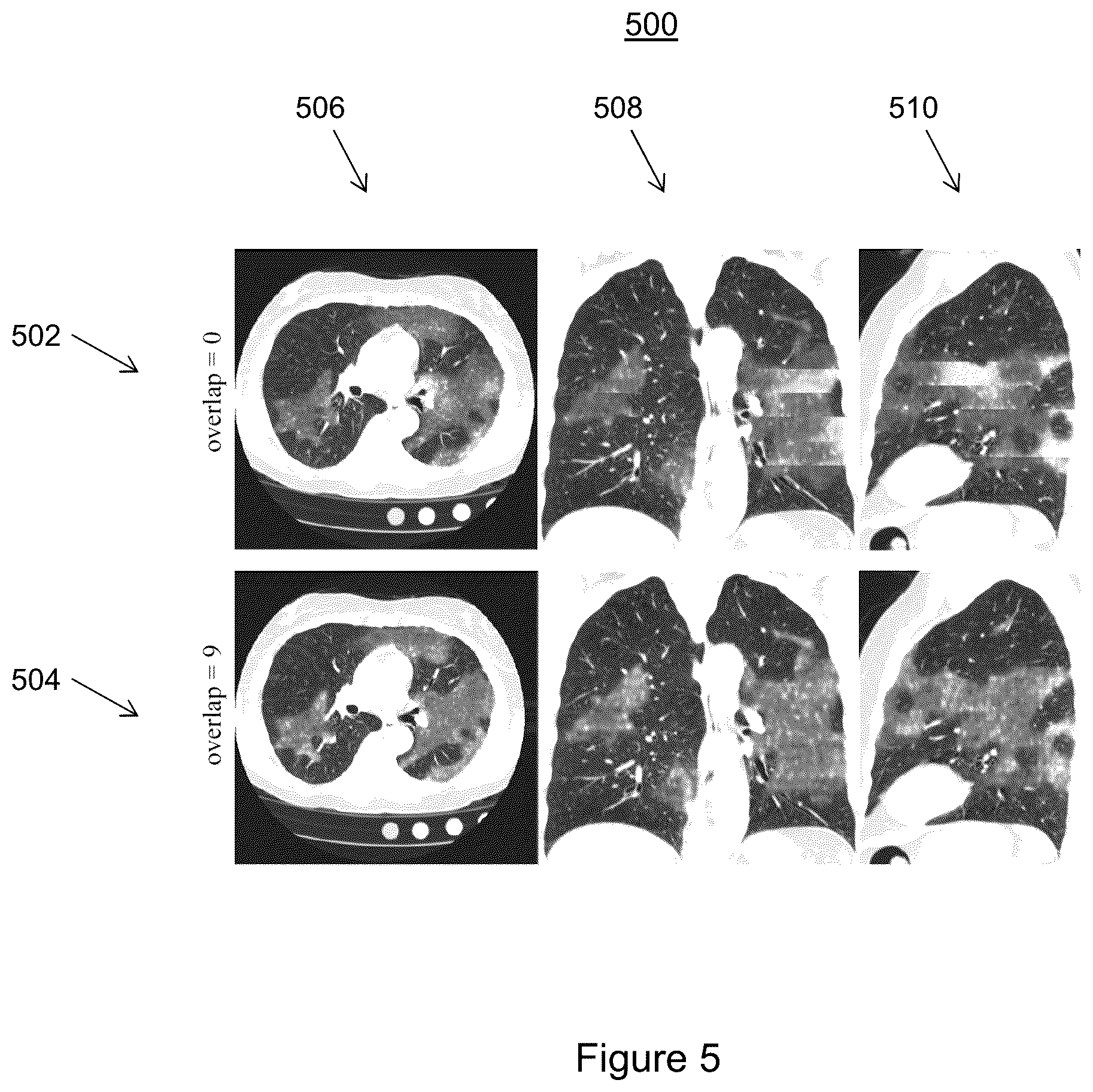 Patent US11810291 Figure 5 – Medical image synthesis of abnormality patterns associated with COVID-19