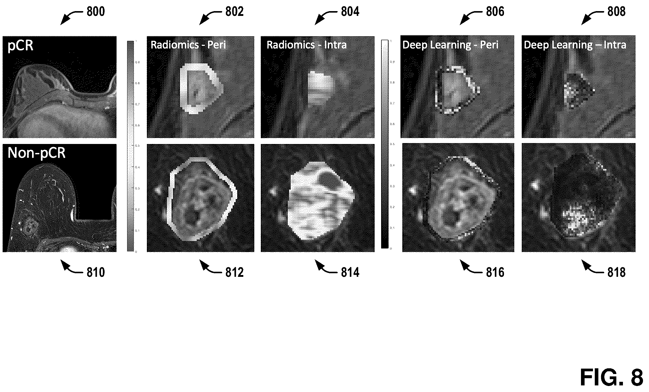 Patent US11810292 Figure 8 – Disease characterization and response estimation through spatially-invoked radiomics and deep learning fusion