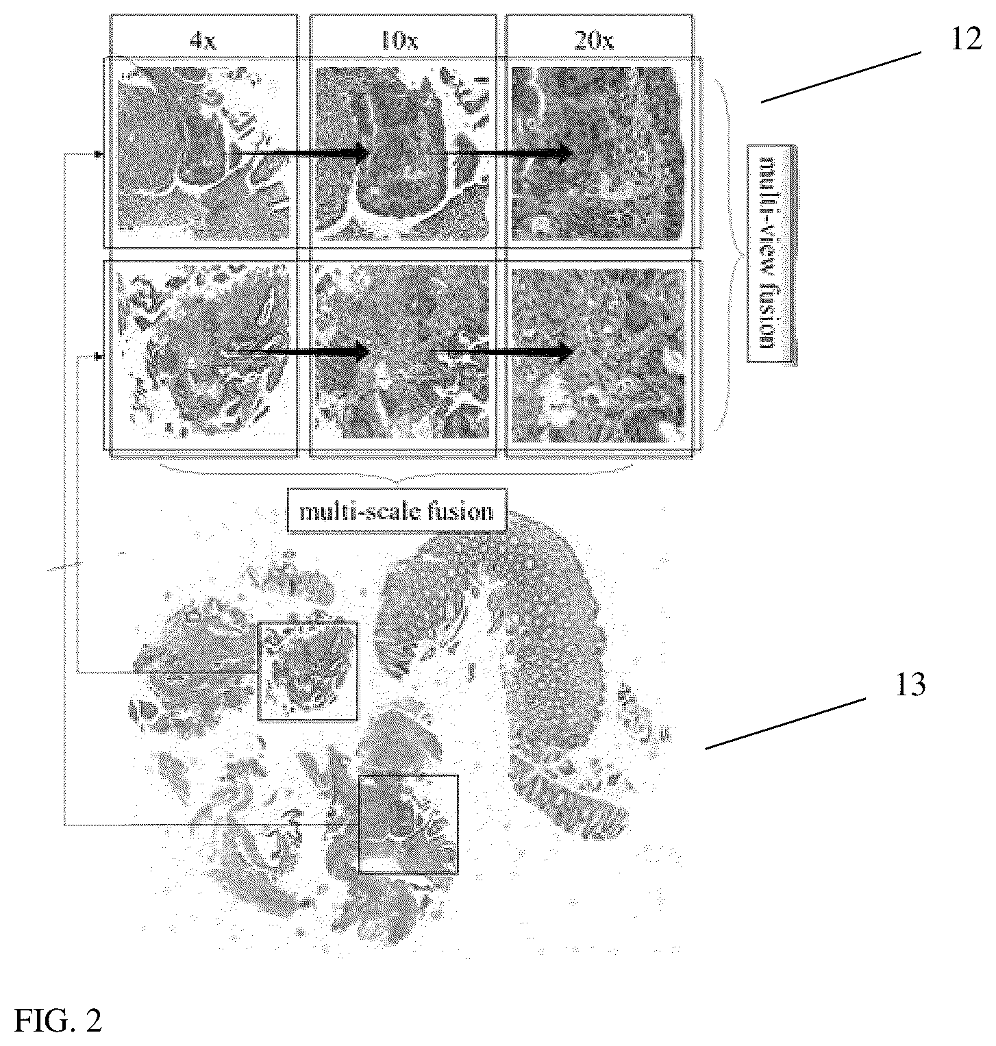 Patent US11810297 Figure 2 – Computer aided diagnosis system for detecting tissue lesion on microscopy images based on multi-resolution feature fusion