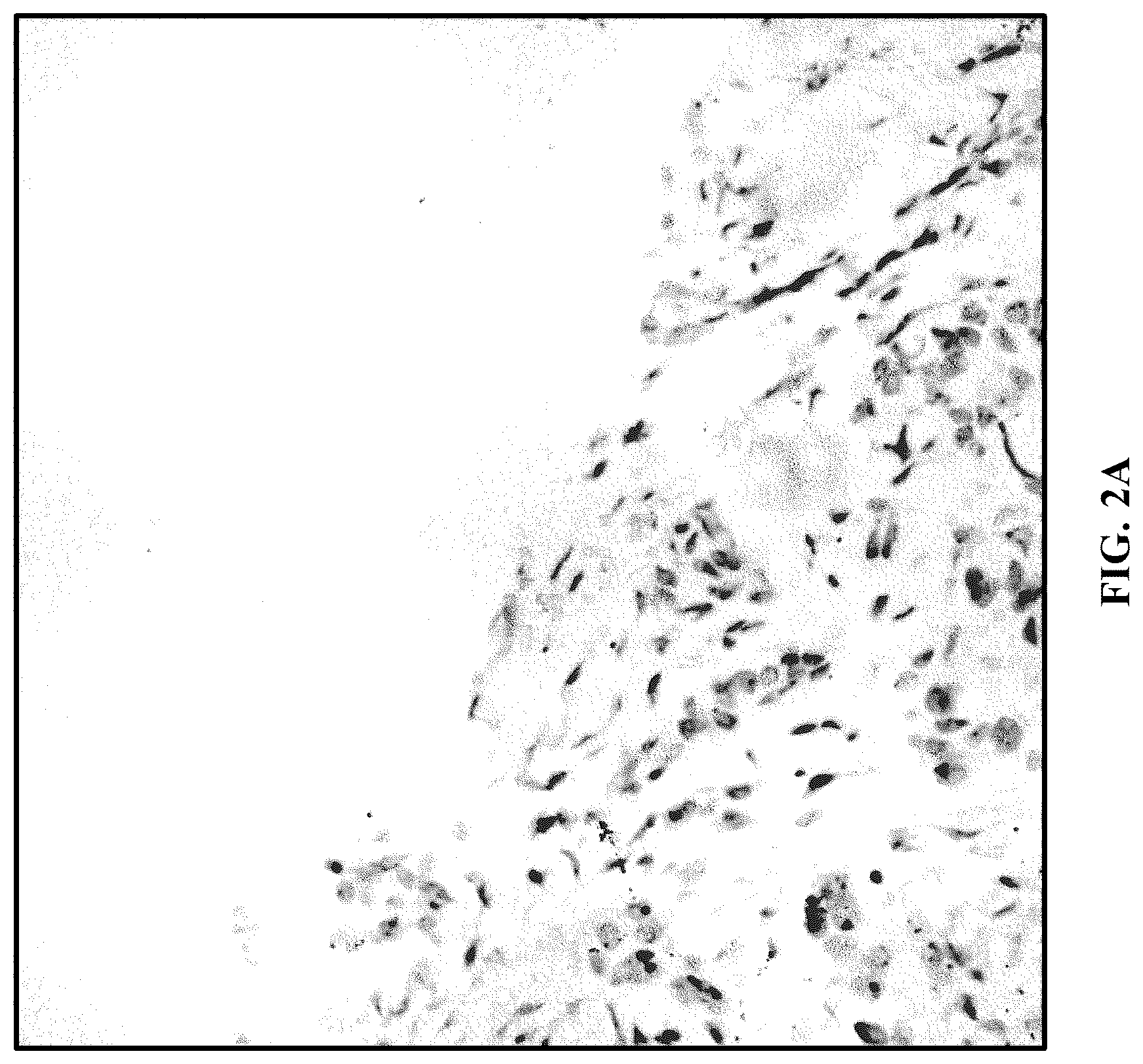 Patent US11810305 Figure 2 – Foreground segmentation and nucleus ranking for scoring dual ISH images