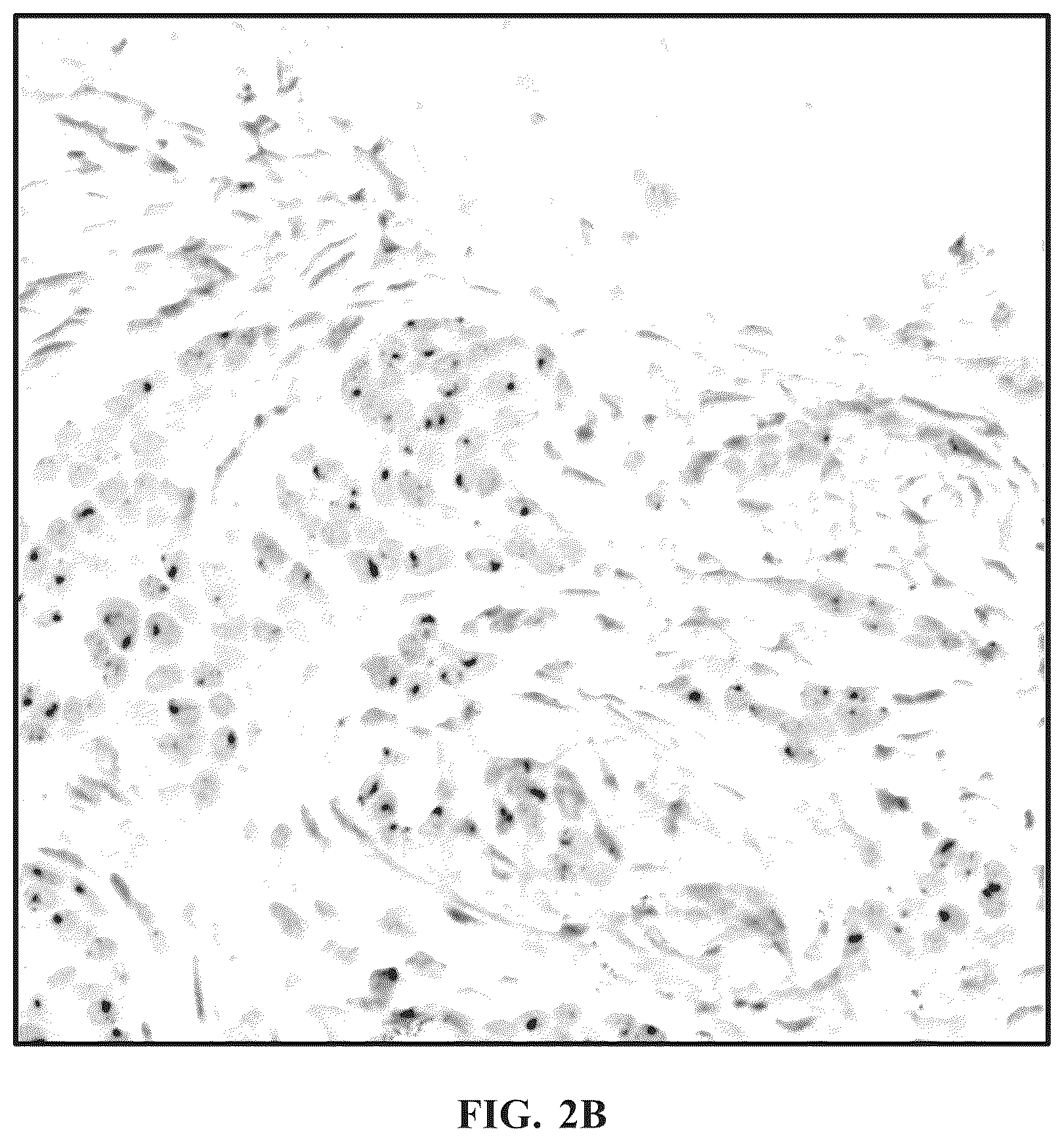 Patent US11810305 Figure 3 – Foreground segmentation and nucleus ranking for scoring dual ISH images