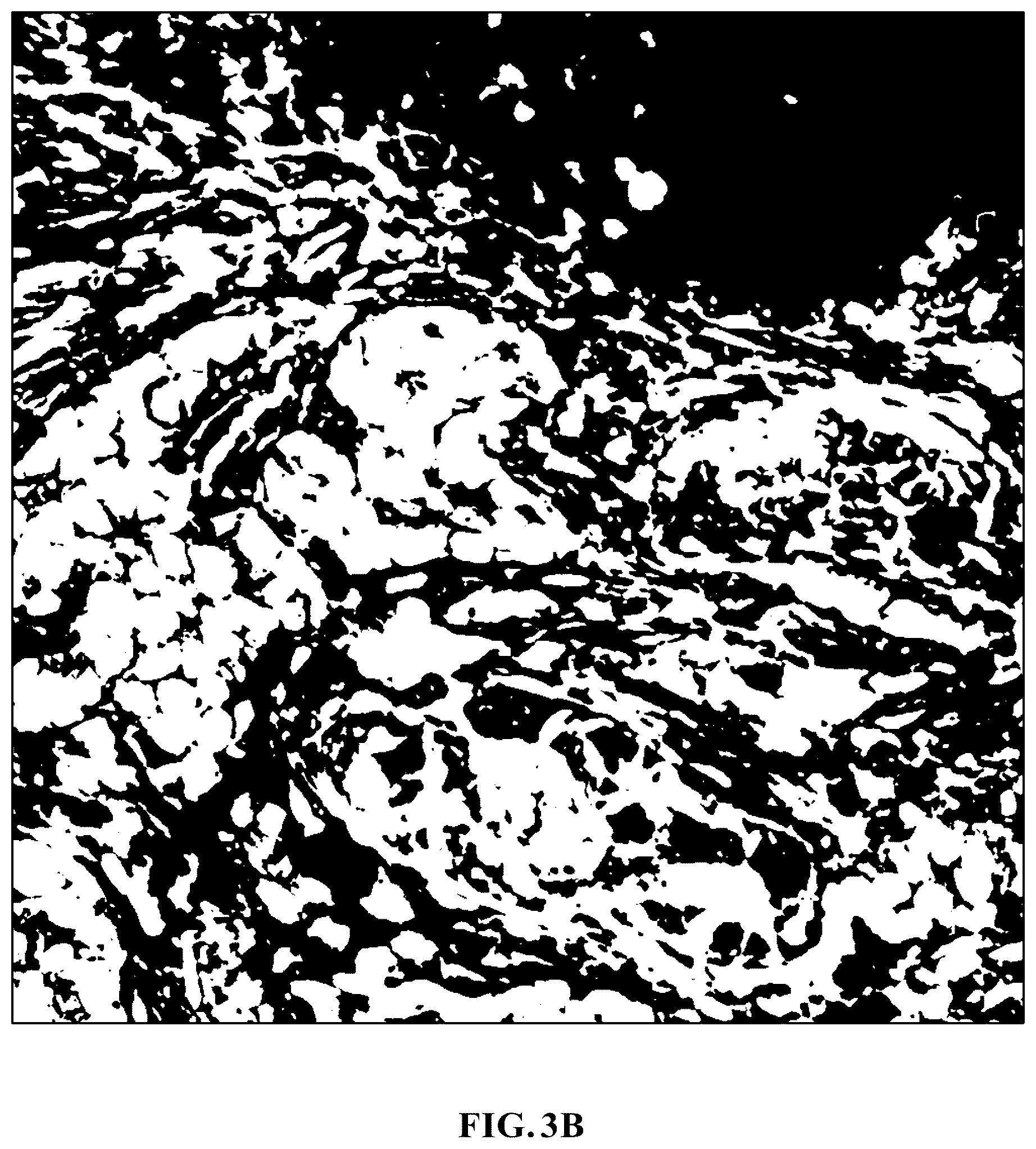 Patent US11810305 Figure 5 – Foreground segmentation and nucleus ranking for scoring dual ISH images