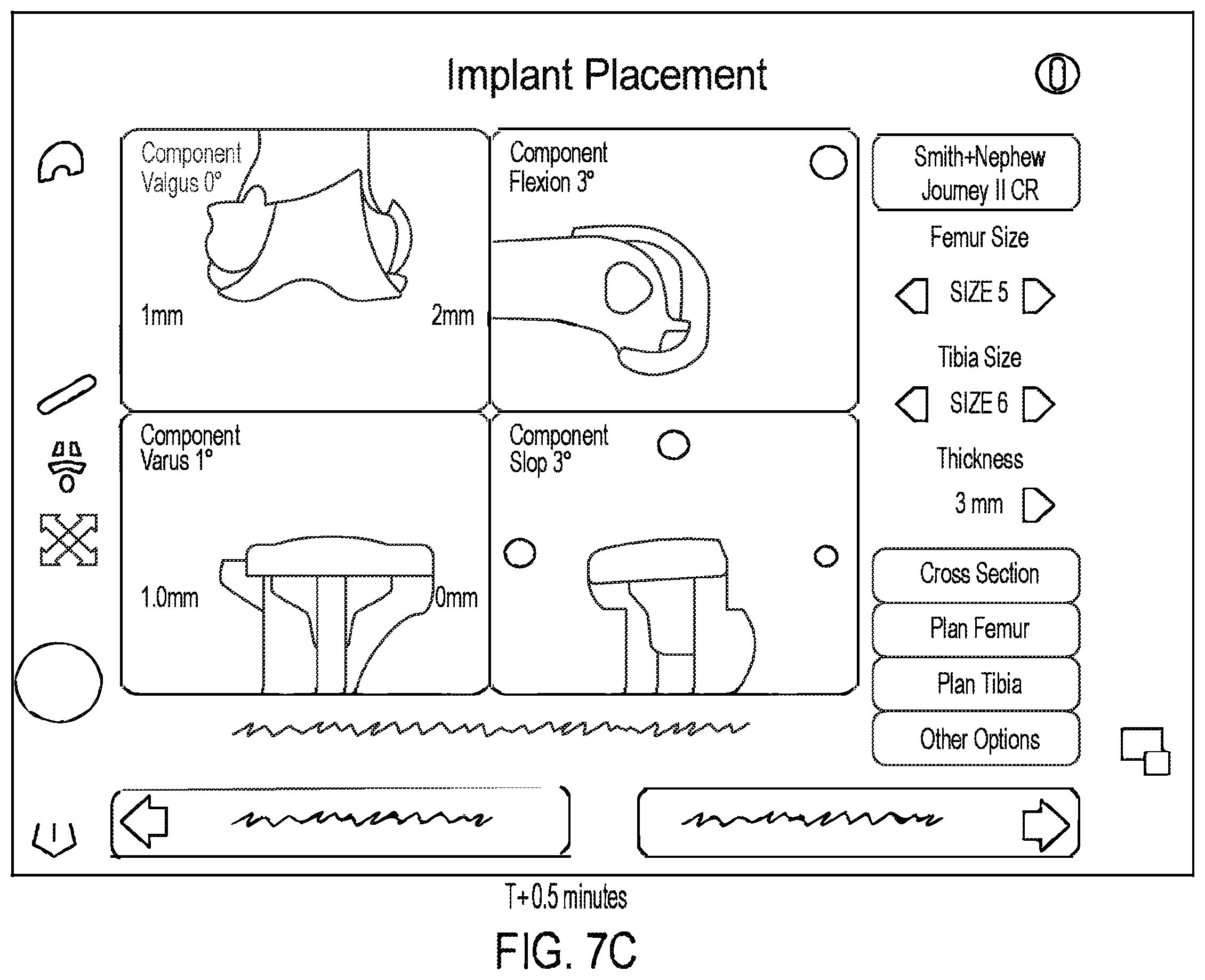Patent US11810360 Figure 11 – Methods for arthroscopic surgery video segmentation and devices therefor