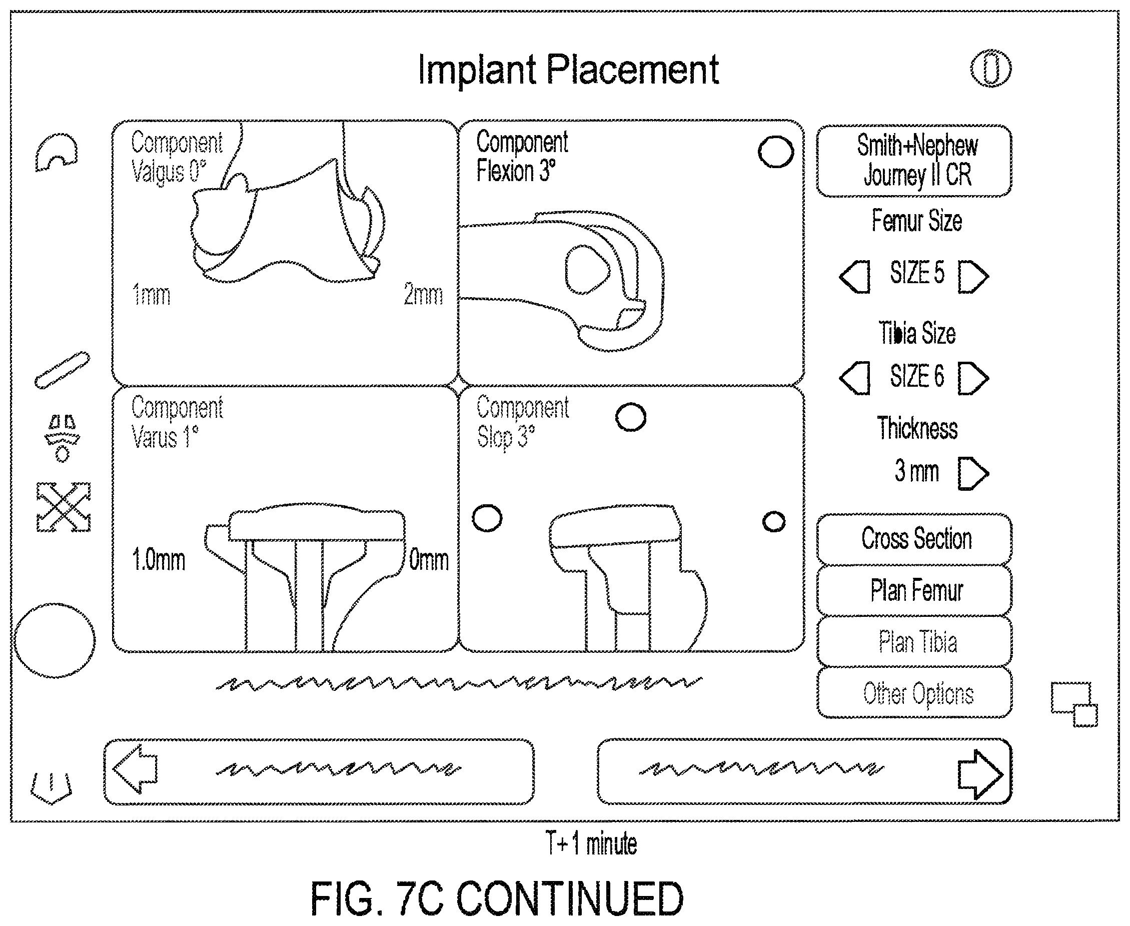 Patent US11810360 Figure 12 – Methods for arthroscopic surgery video segmentation and devices therefor