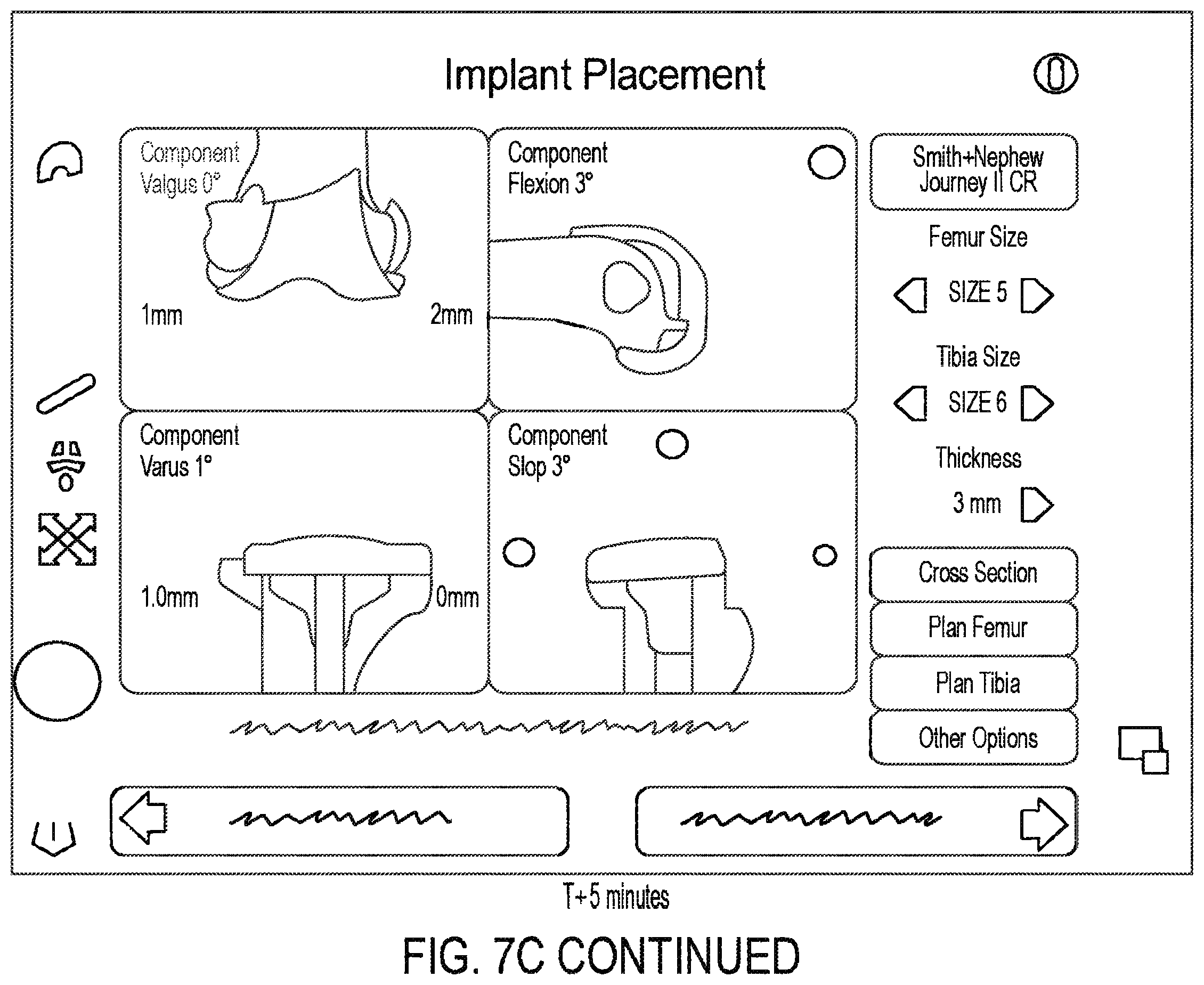 Patent US11810360 Figure 13 – Methods for arthroscopic surgery video segmentation and devices therefor