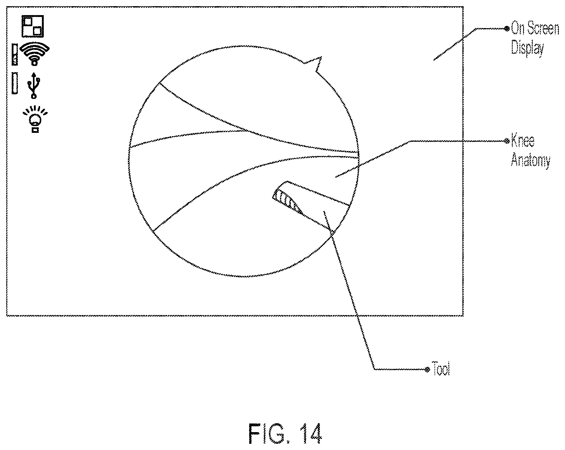 Patent US11810360 Figure 20 – Methods for arthroscopic surgery video segmentation and devices therefor