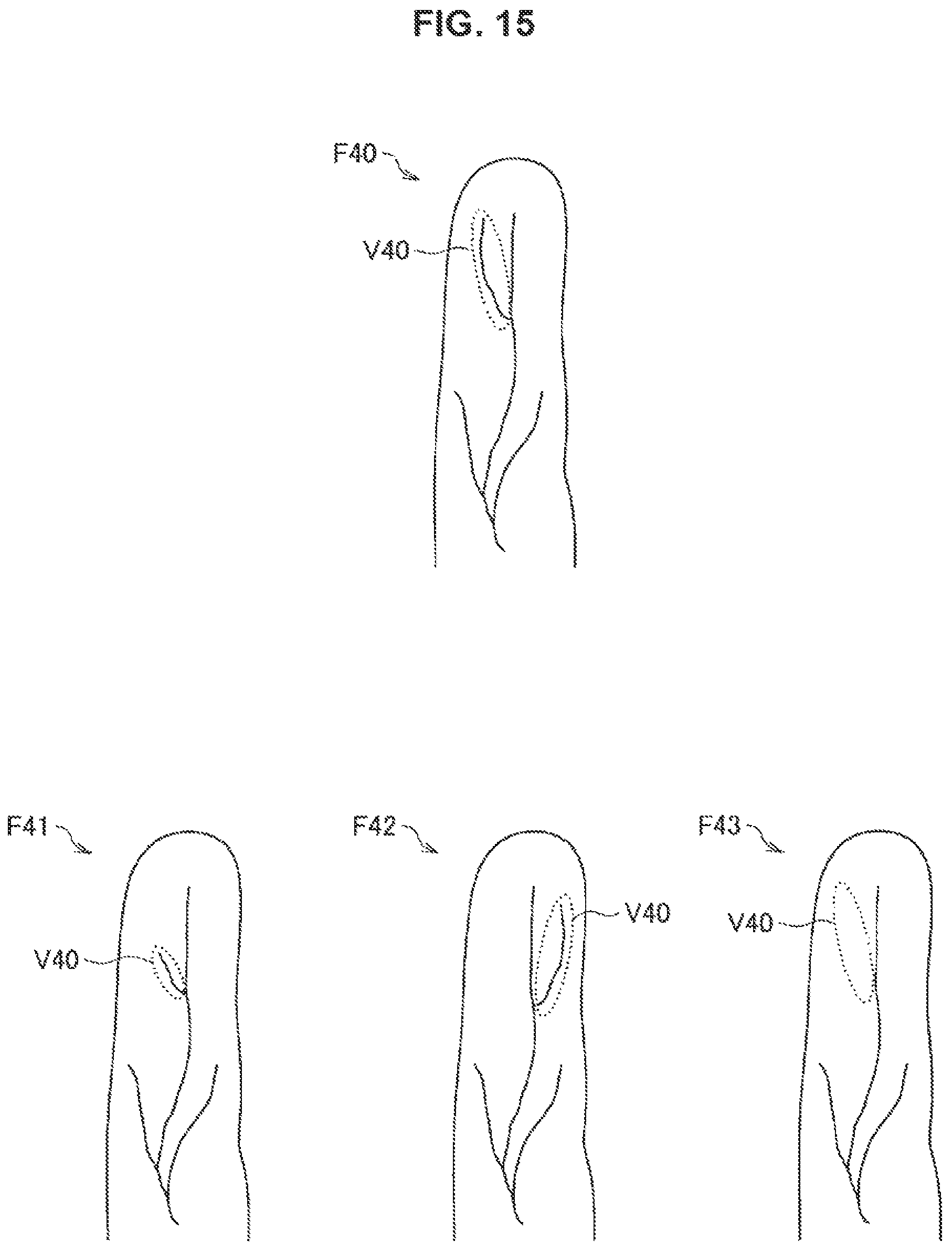 Patent US11810399 Figure 14 – Information processing device, information processing method, and program