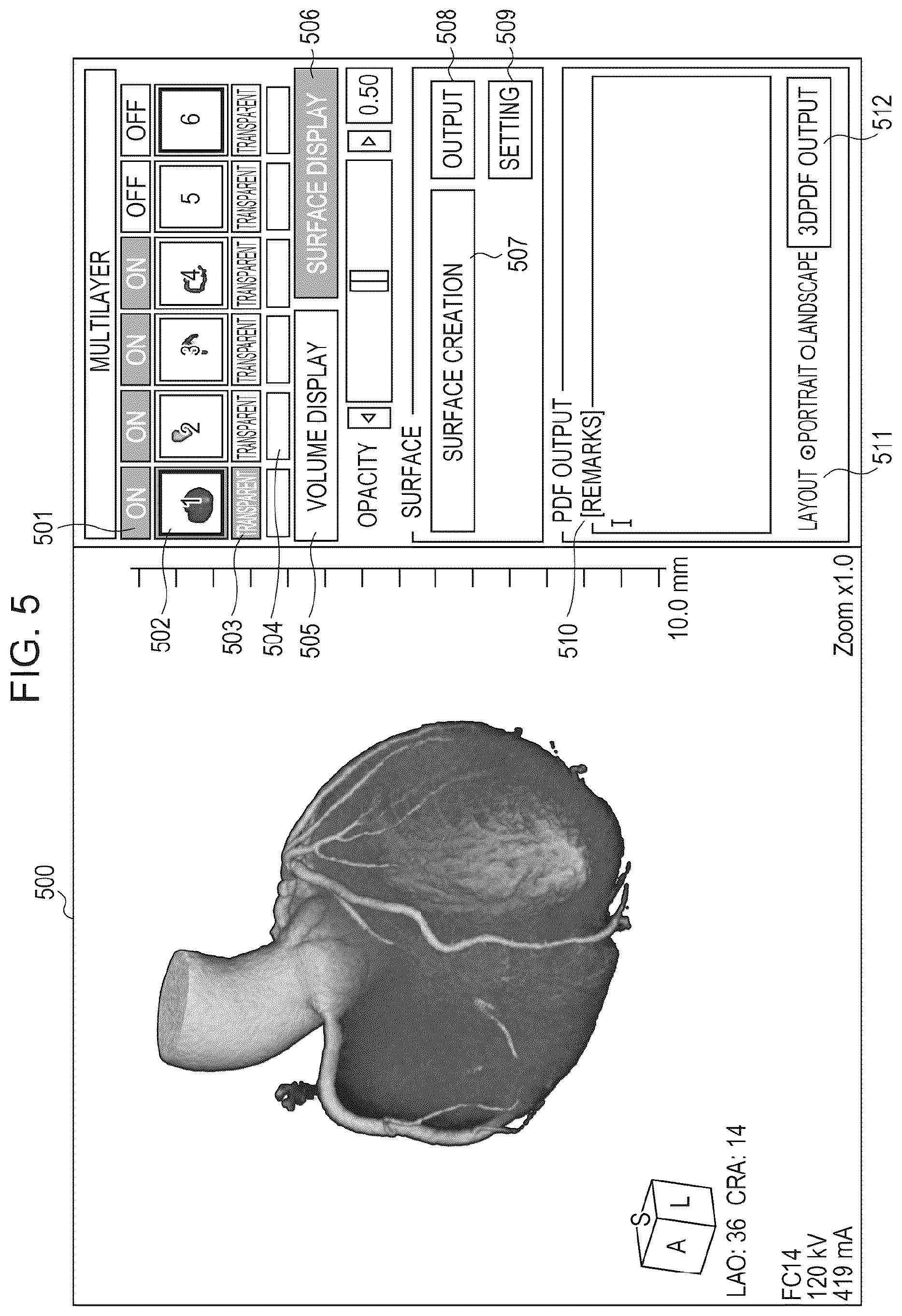 Patent US11810659 Figure 4 – Medical image processing apparatus, program installable into medical image processing apparatus, and medical image processing method