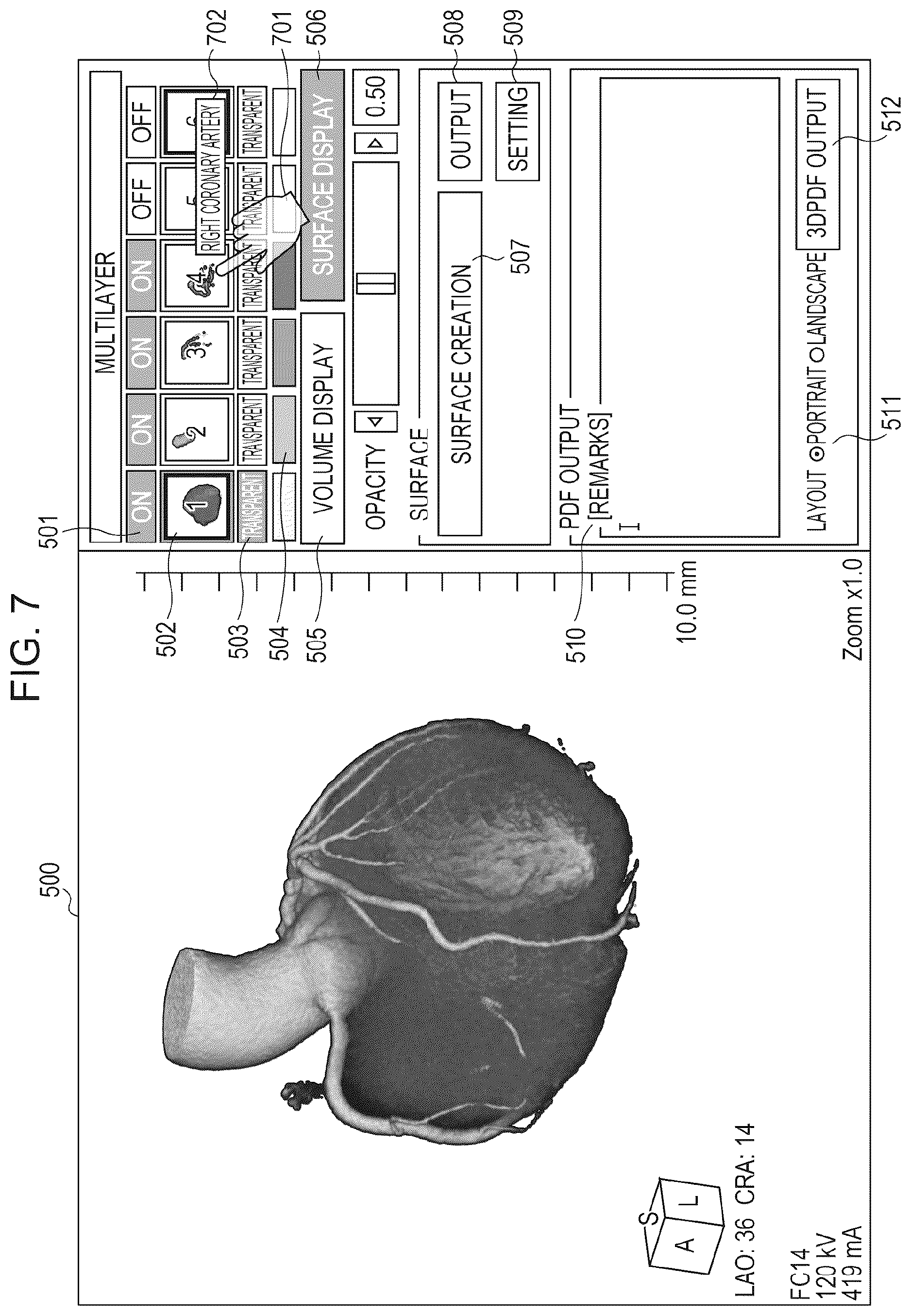 Patent US11810659 Figure 6 – Medical image processing apparatus, program installable into medical image processing apparatus, and medical image processing method