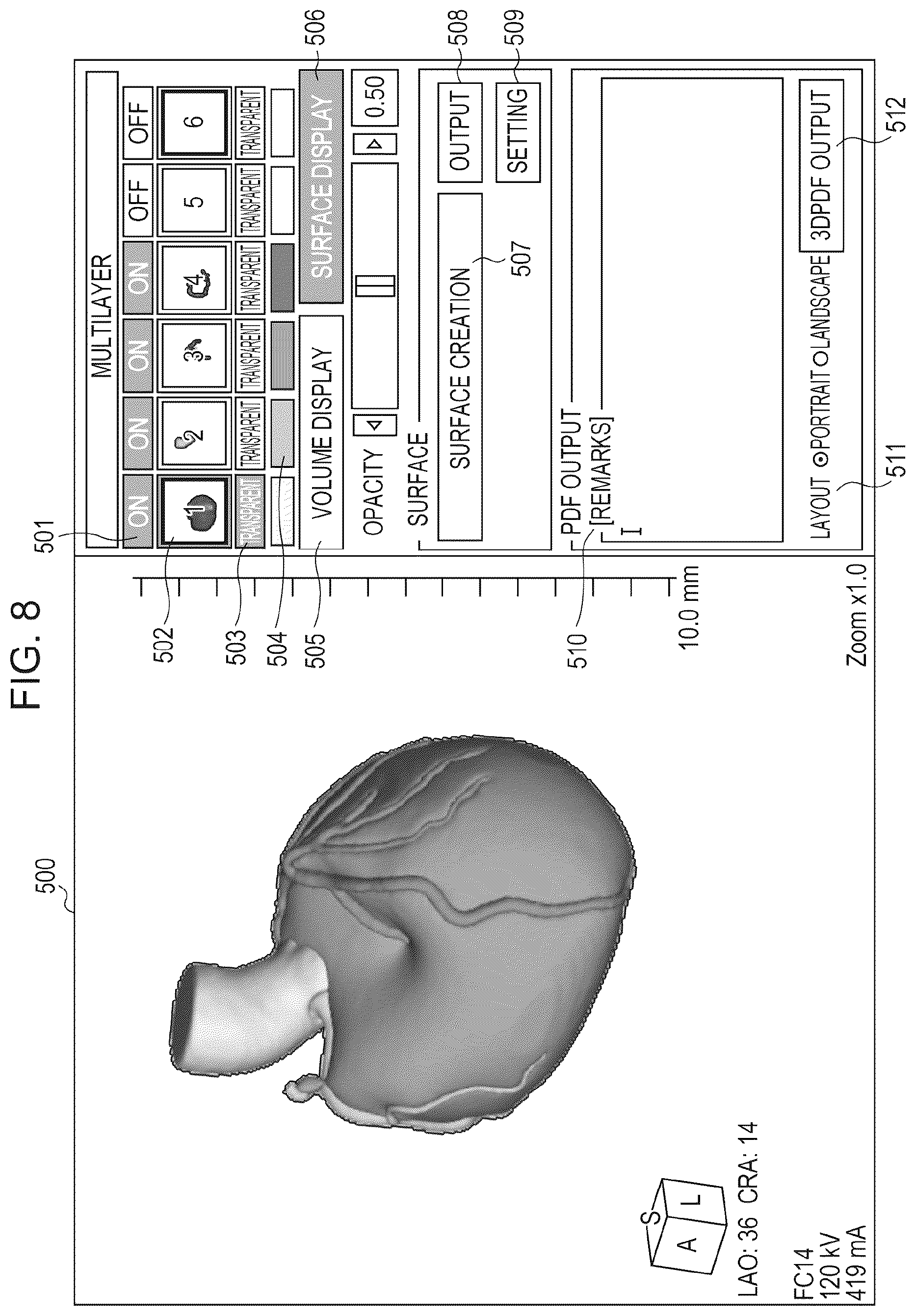Patent US11810659 Figure 7 – Medical image processing apparatus, program installable into medical image processing apparatus, and medical image processing method