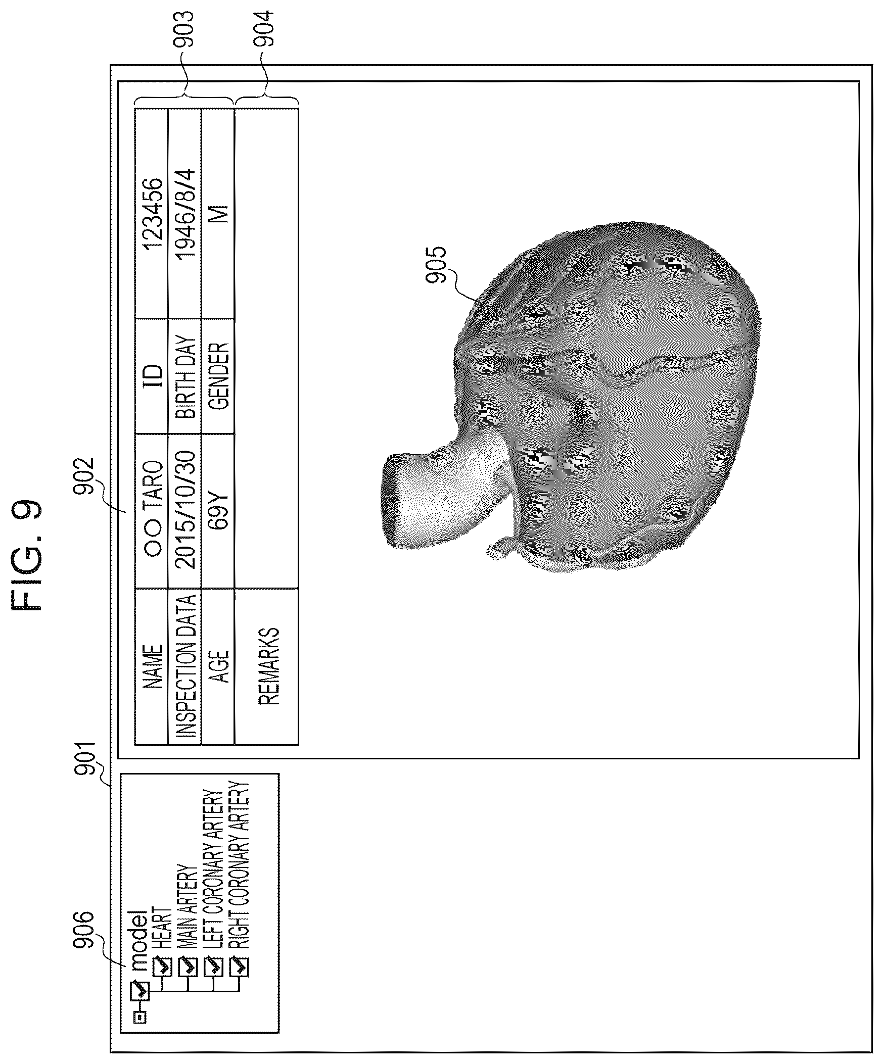 Patent US11810659 Figure 8 – Medical image processing apparatus, program installable into medical image processing apparatus, and medical image processing method