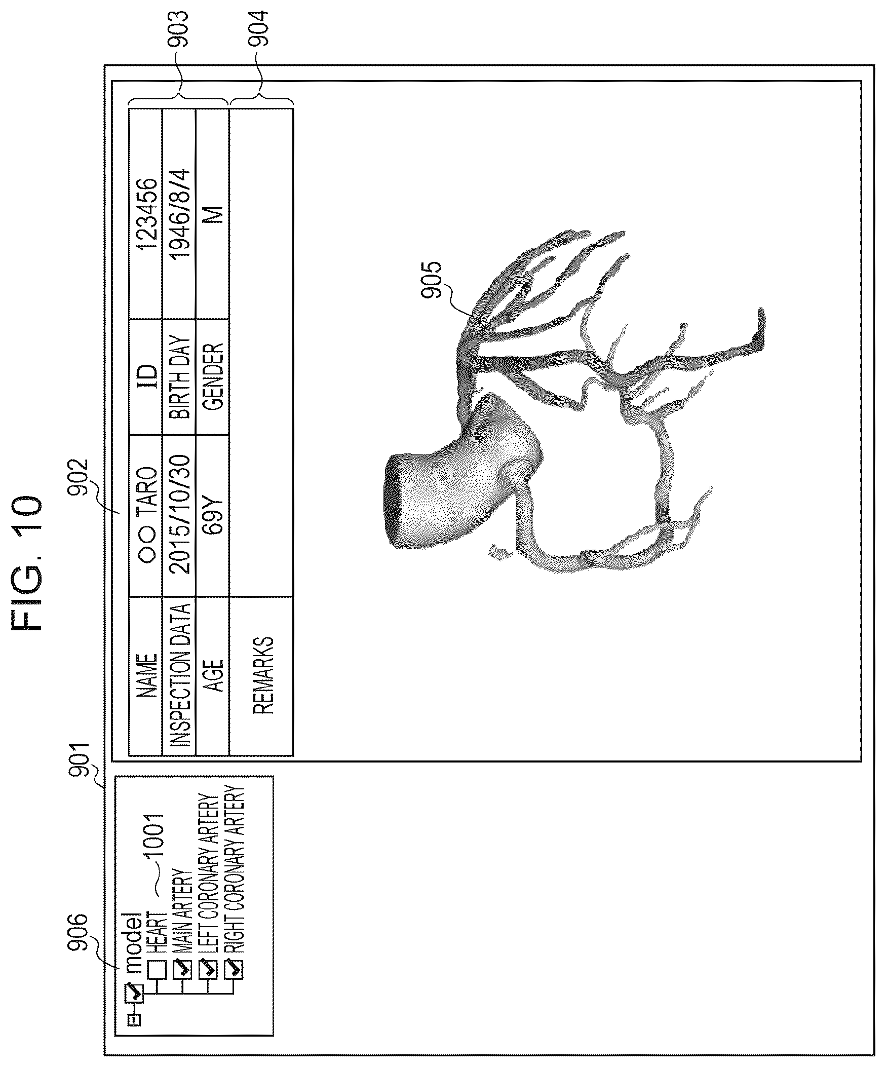 Patent US11810659 Figure 9 – Medical image processing apparatus, program installable into medical image processing apparatus, and medical image processing method