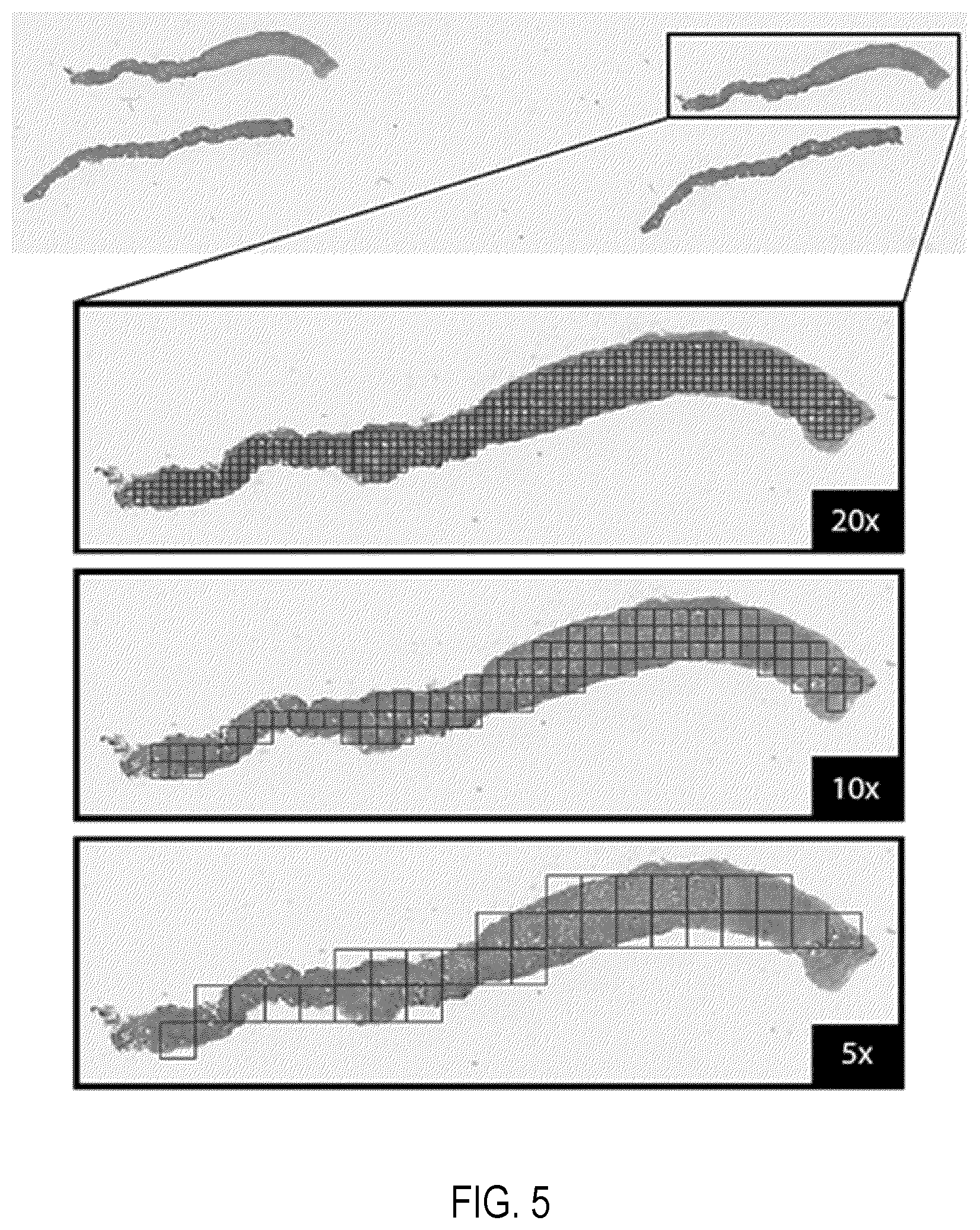 Patent US11810677 Figure 5 – Systems and methods for multiple instance learning for classification and localization in biomedical imaging