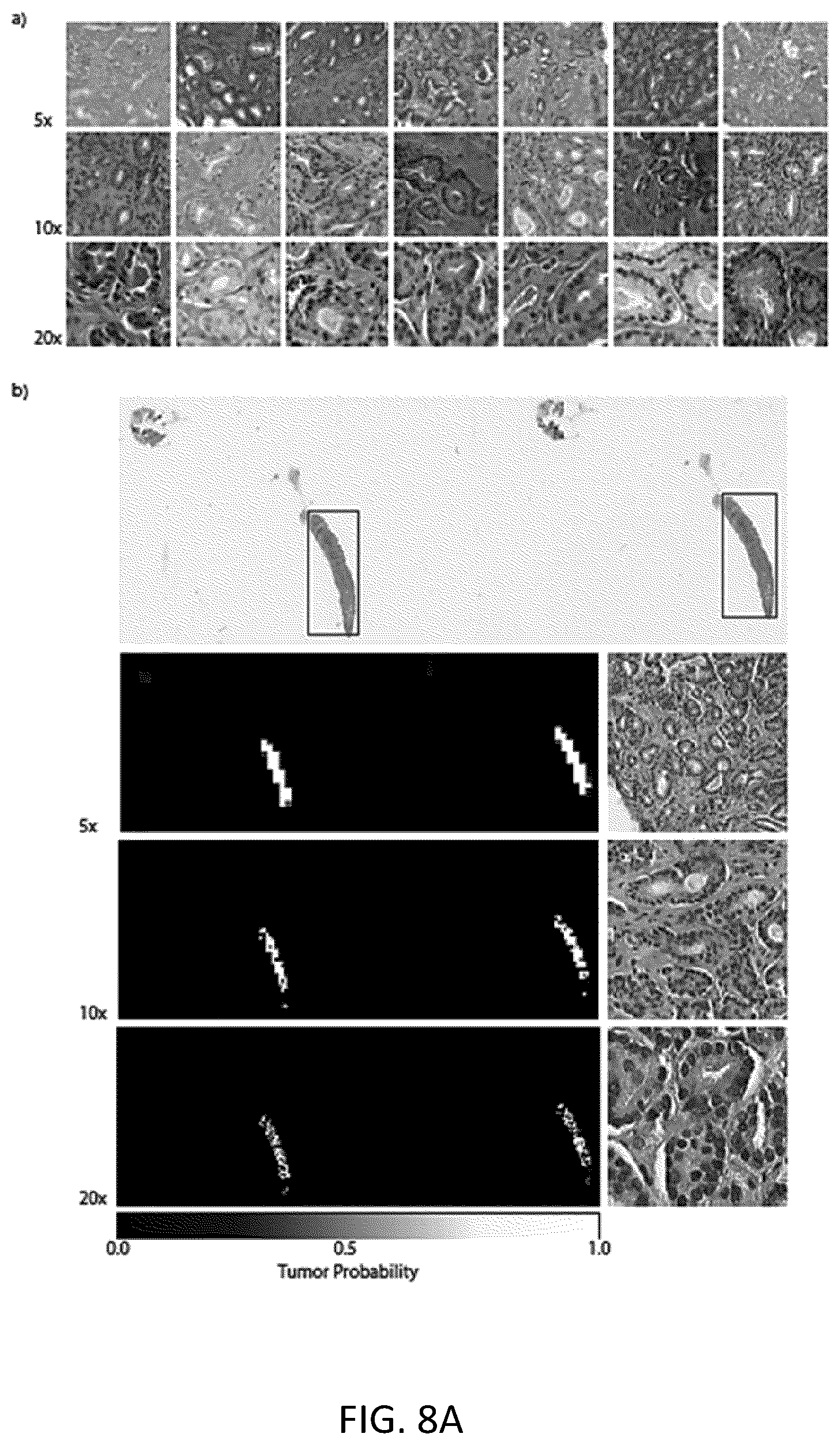 Patent US11810677 Figure 11 – Systems and methods for multiple instance learning for classification and localization in biomedical imaging