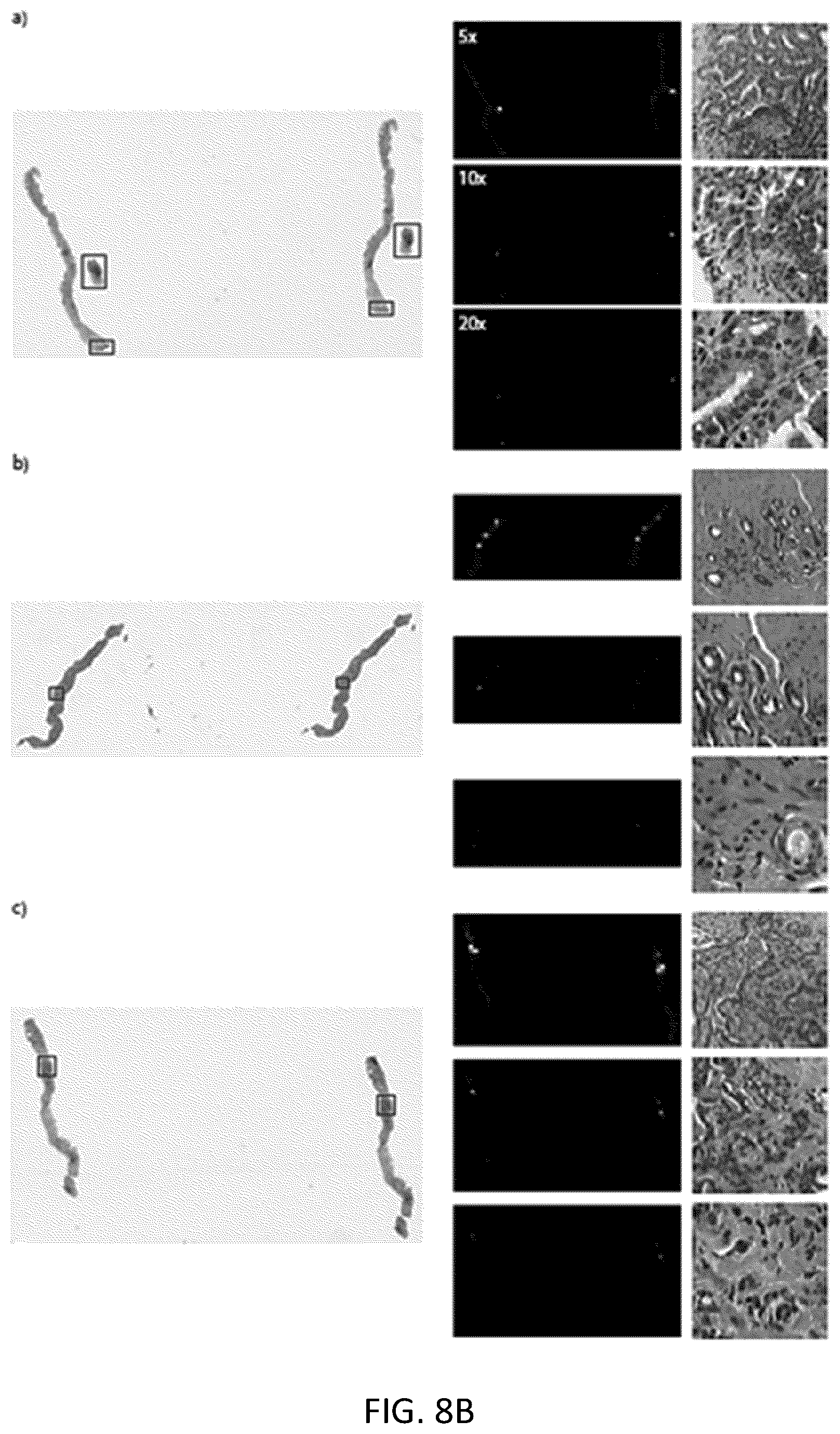 Patent US11810677 Figure 12 – Systems and methods for multiple instance learning for classification and localization in biomedical imaging