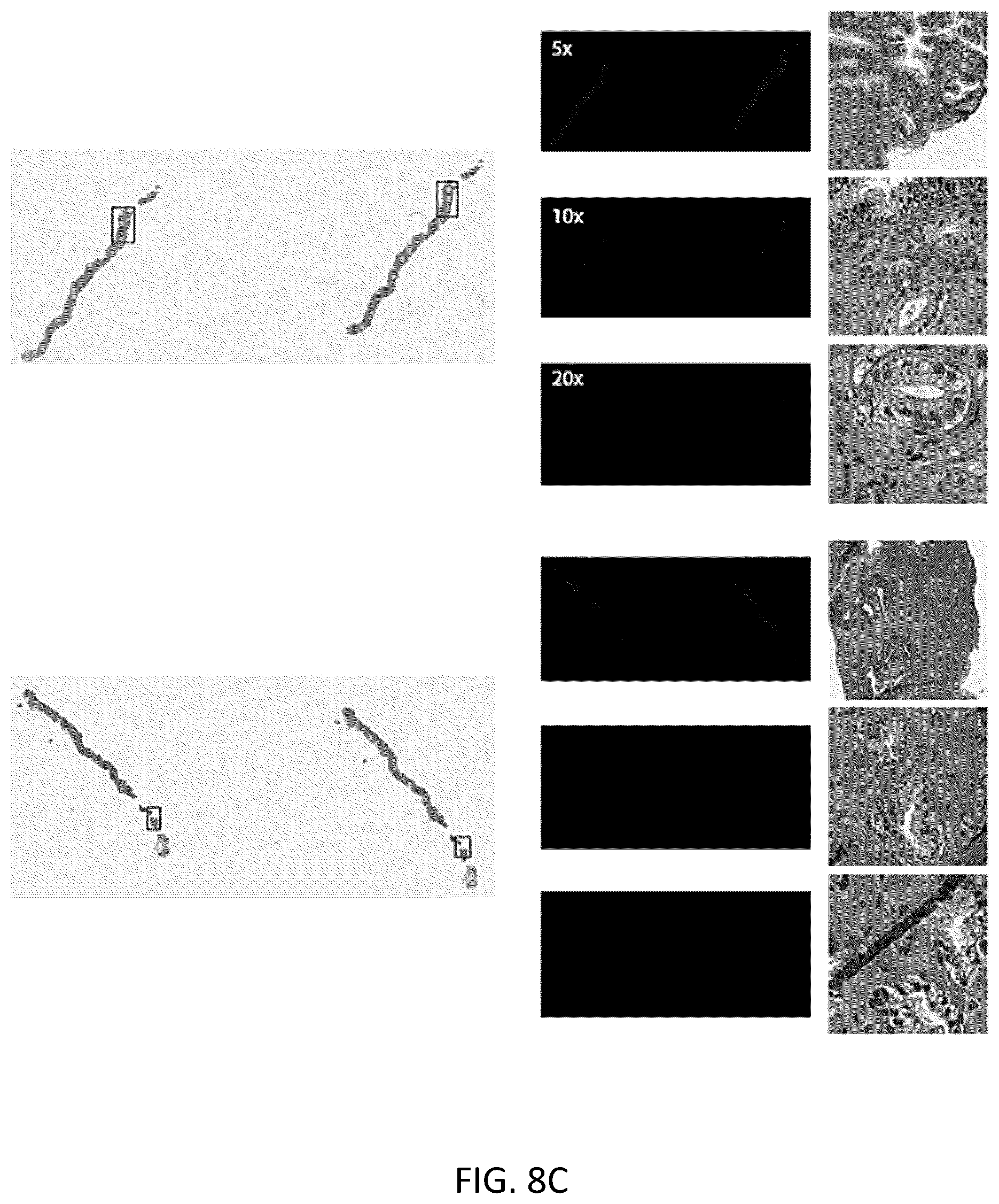 Patent US11810677 Figure 13 – Systems and methods for multiple instance learning for classification and localization in biomedical imaging