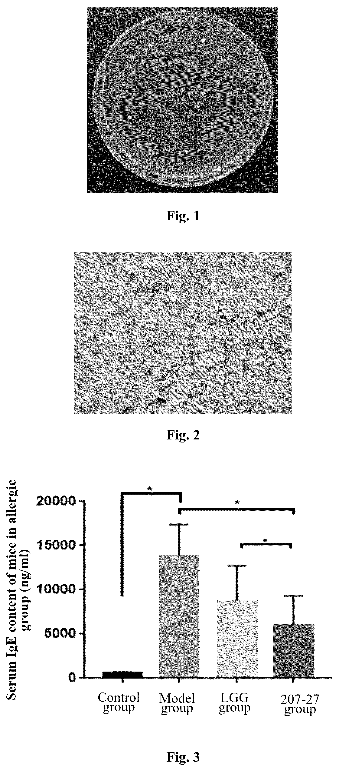 Patent US11812770 Figure 1 – Lactobacillus paracasei 207-27 and use thereof