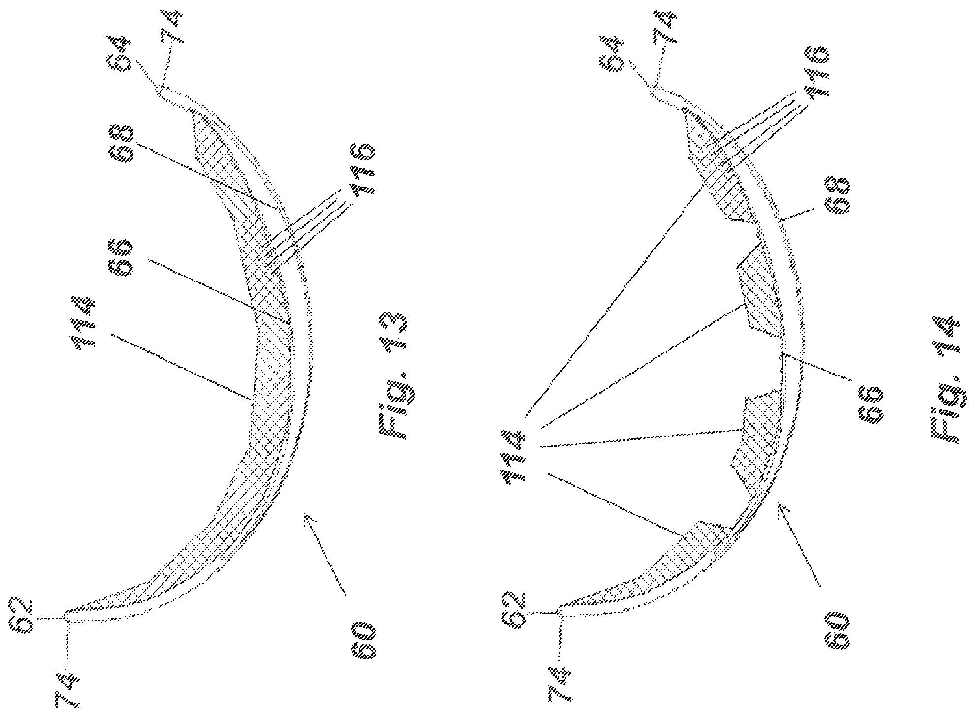 Patent US11812796 Figure 13 – Brassiere with anchored under supports