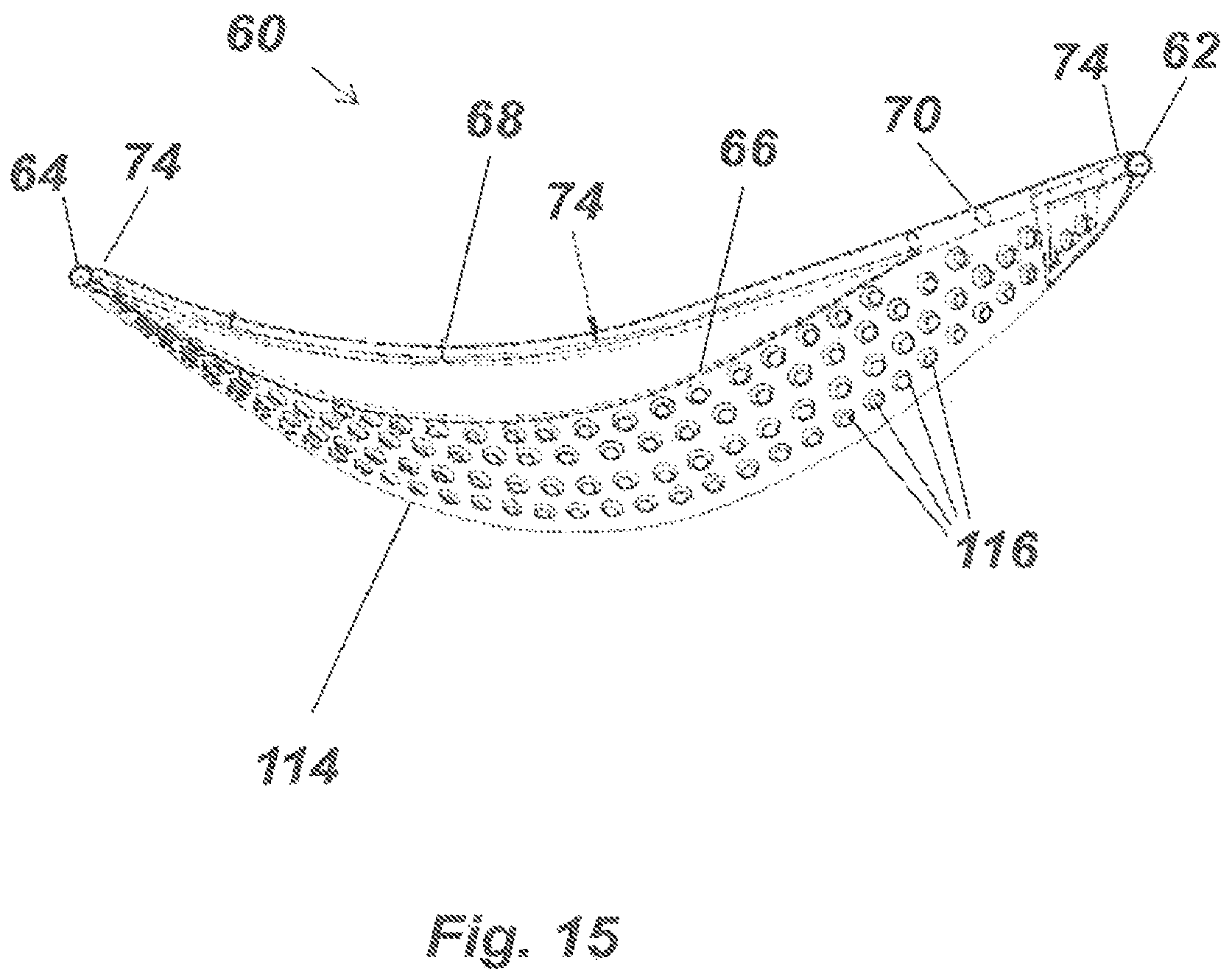 Patent US11812796 Figure 14 – Brassiere with anchored under supports