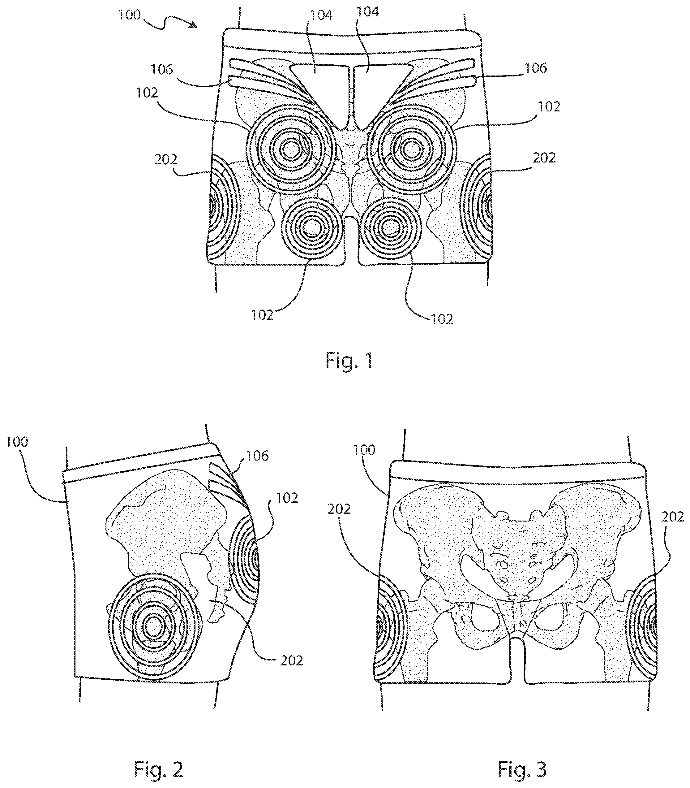 Patent US11812804 Figure 1 – Decubitus ulcers prevention garment
