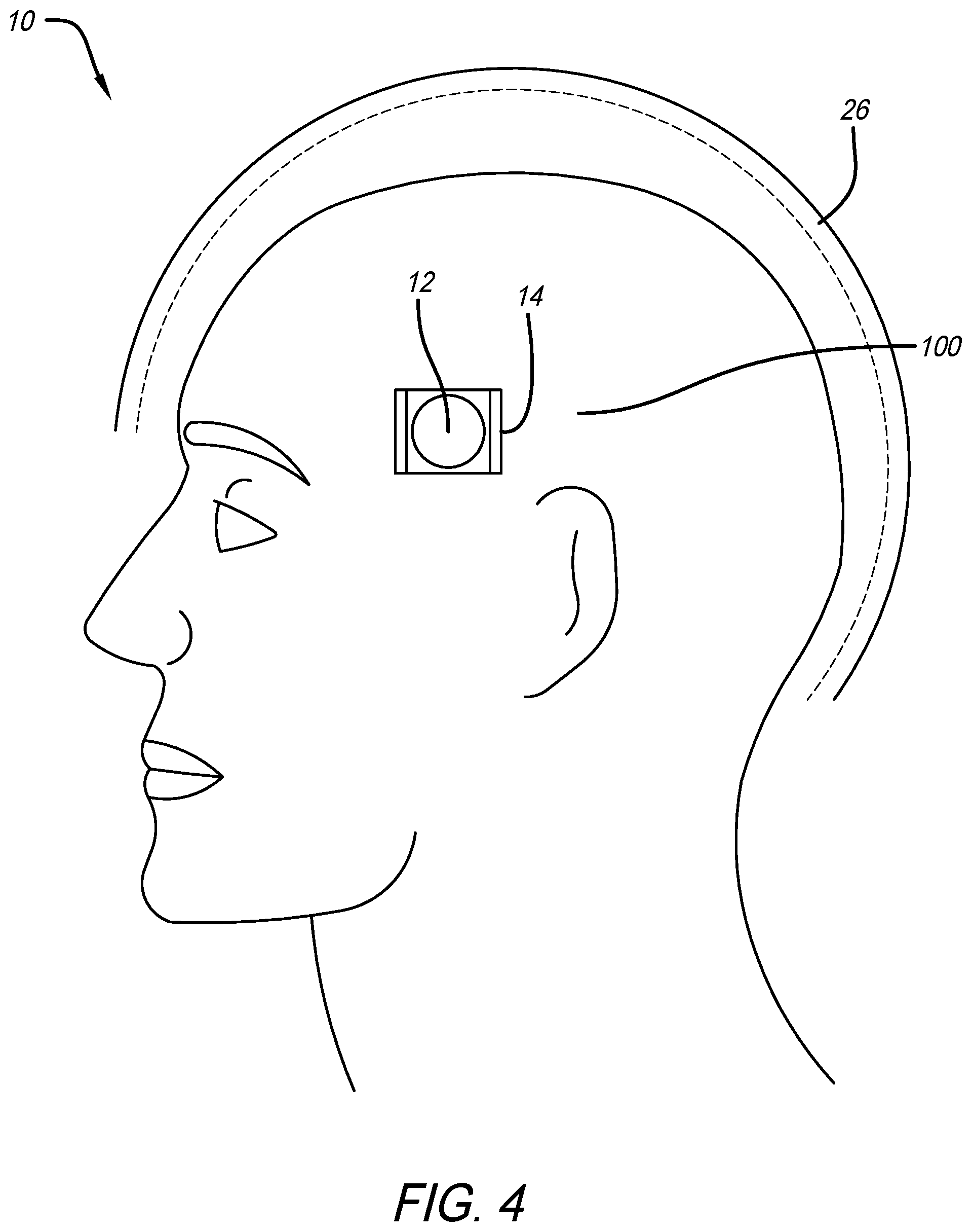 Patent US11812808 Figure 4 – Helmet including impact and health data sensing system