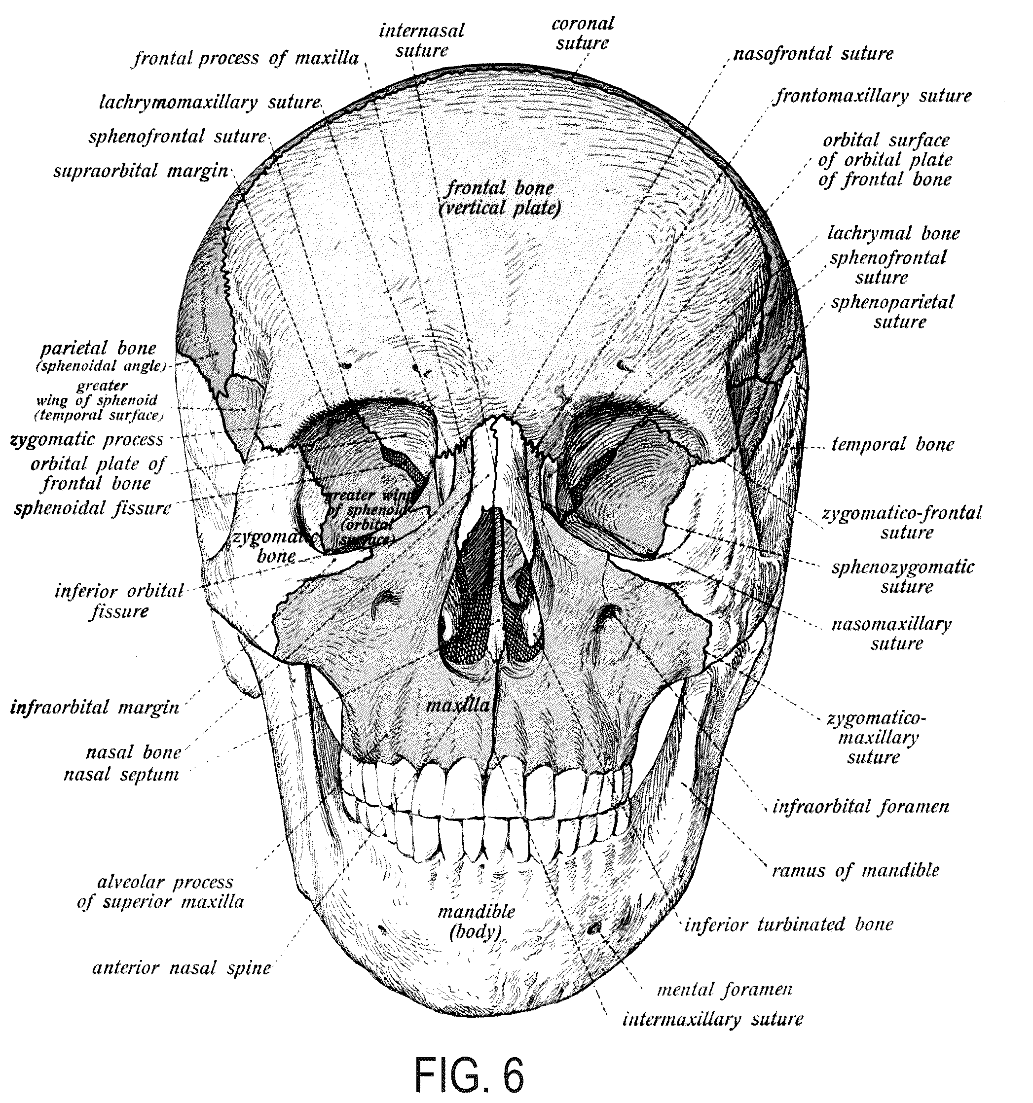 Patent US11812809 Figure 4 – Helmet with extended portions configured to protect squamous temporal bones of a wearer