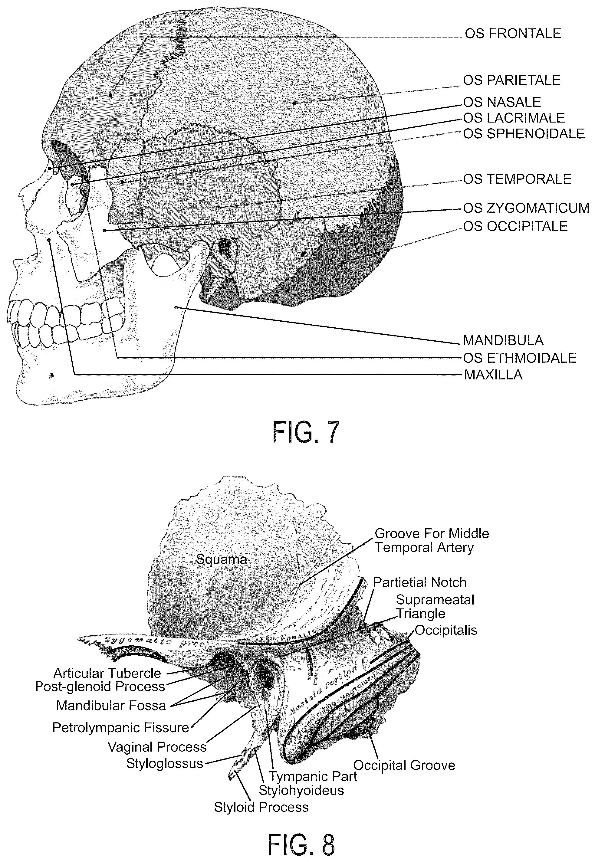 Patent US11812809 Figure 5 – Helmet with extended portions configured to protect squamous temporal bones of a wearer