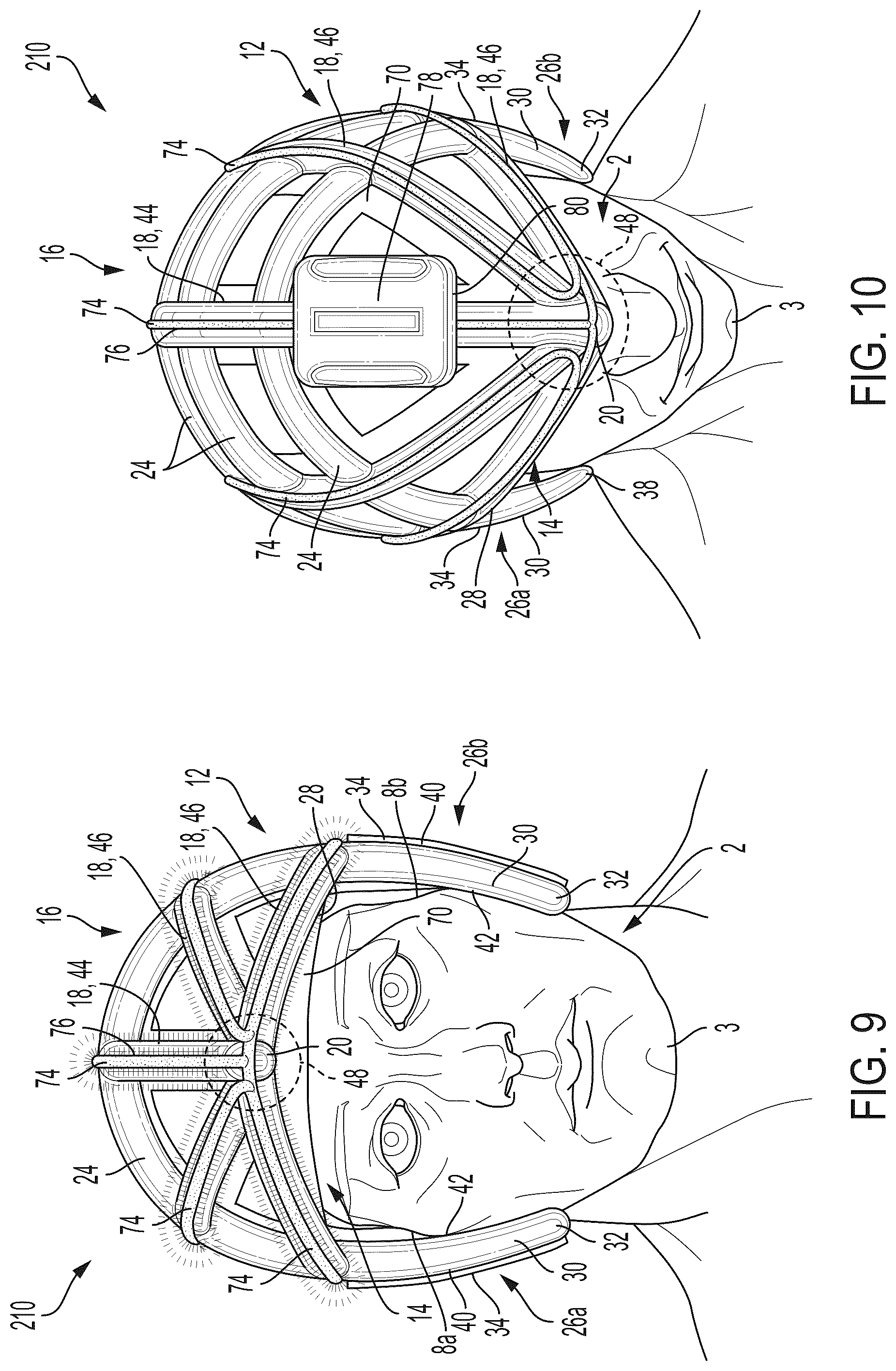Patent US11812809 Figure 6 – Helmet with extended portions configured to protect squamous temporal bones of a wearer