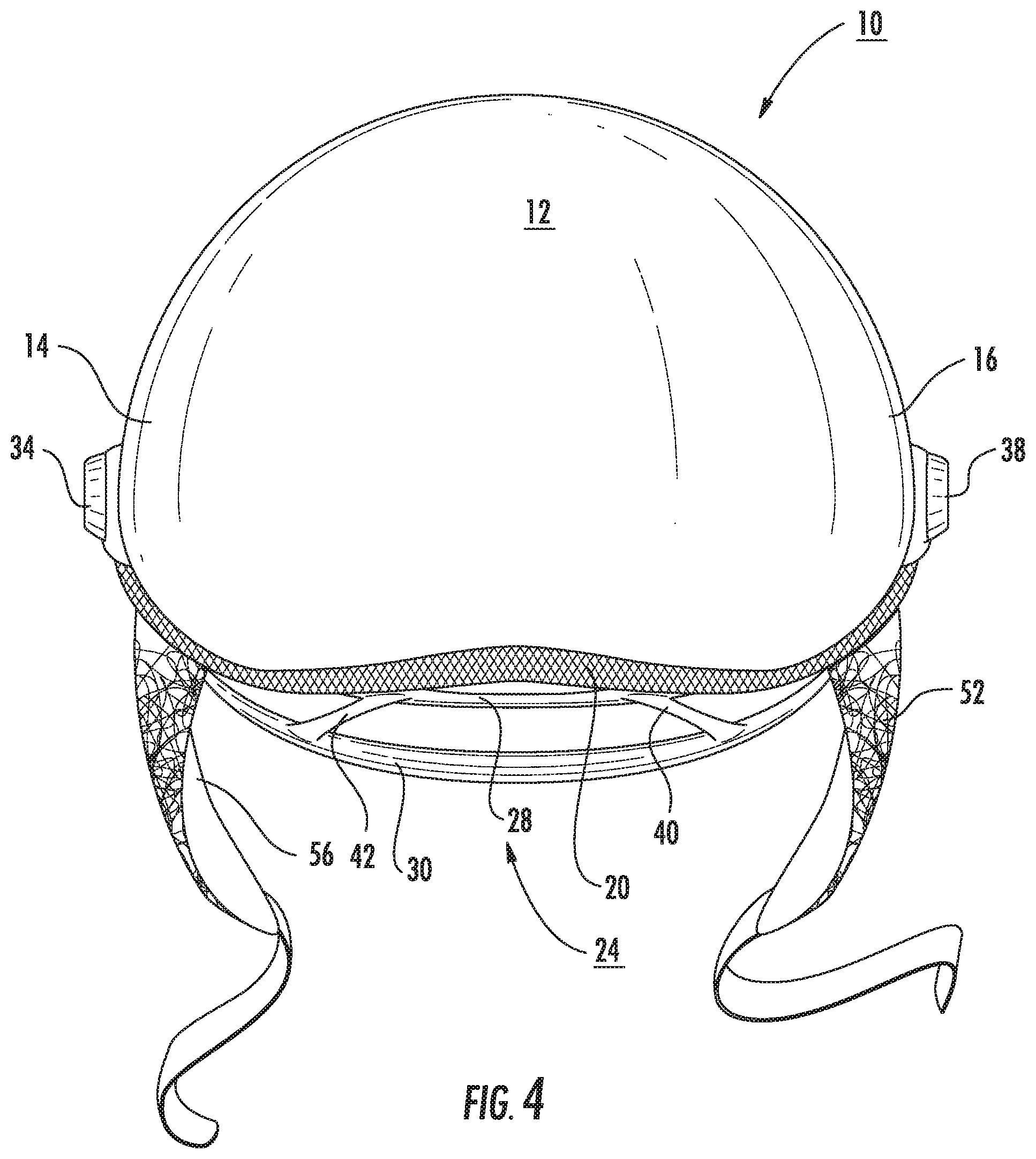 Patent US11812813 Figure 4 – Demi-helmet and mask combination providing facial impact protection and entirely unobstructed views in both forward and peripheral directions, and associated methods