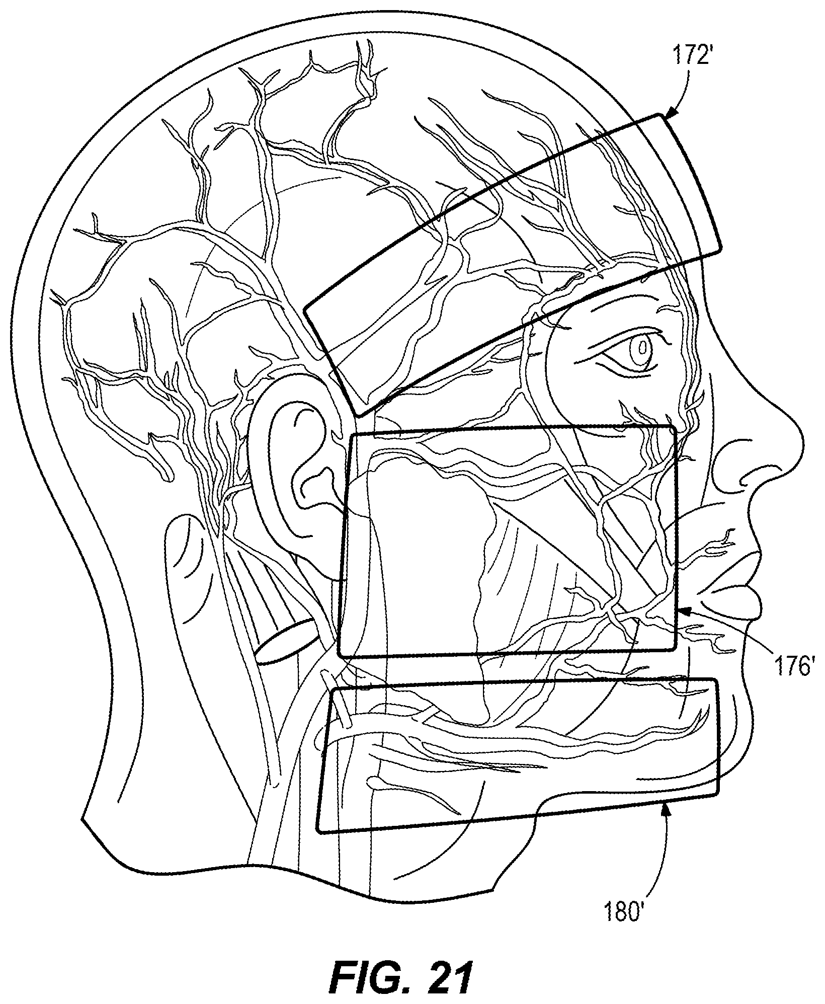 Patent US11812816 Figure 19 – Protective headwear with airflow