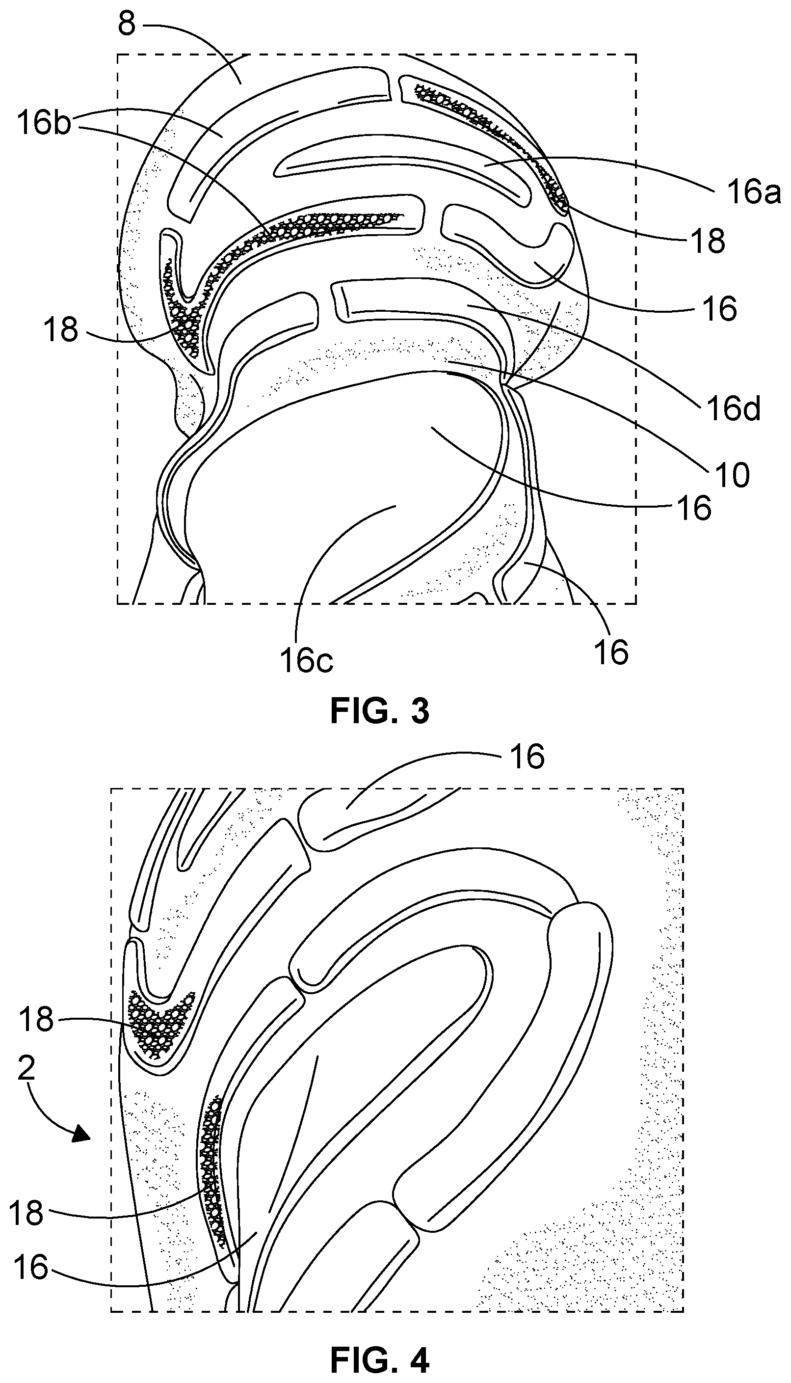 Patent US11812817 Figure 2 – Knitted foot garment and method for treating a knitted foot garment