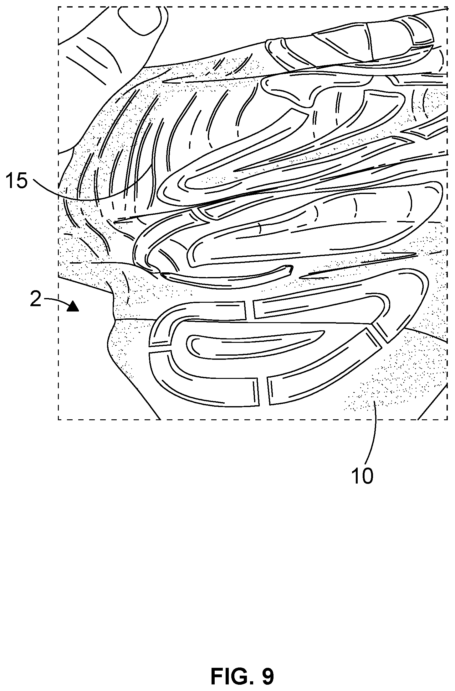 Patent US11812817 Figure 5 – Knitted foot garment and method for treating a knitted foot garment