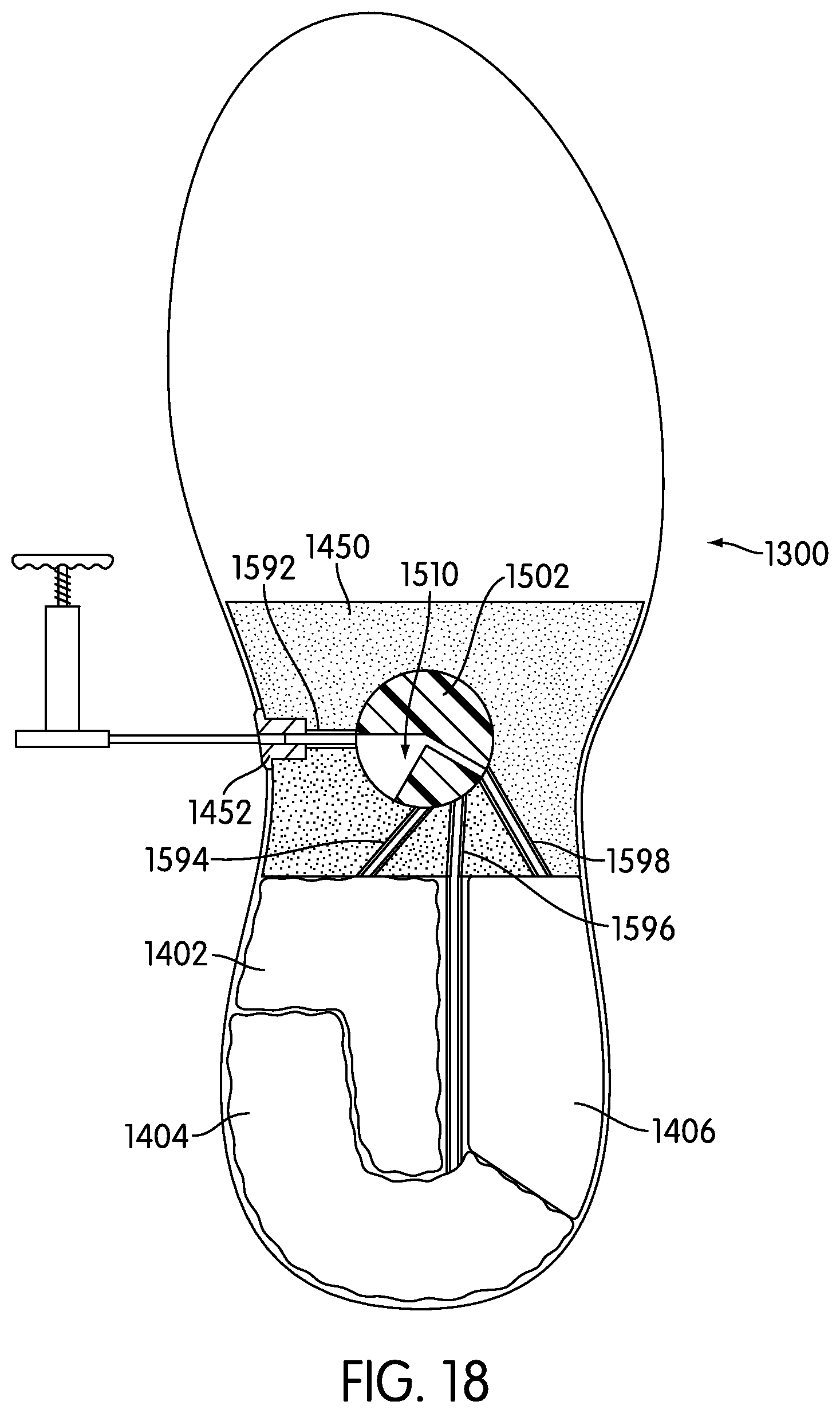 Patent US11812819 Figure 16 – Adjustable multi-bladder system for an article of footwear