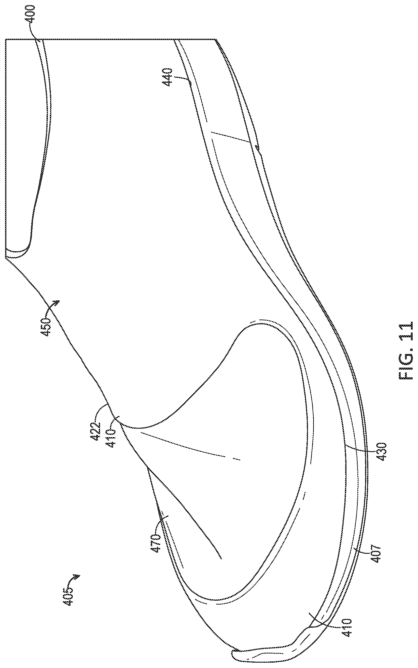 Patent US11812820 Figure 9 – Footwear upper comprising stretch zones