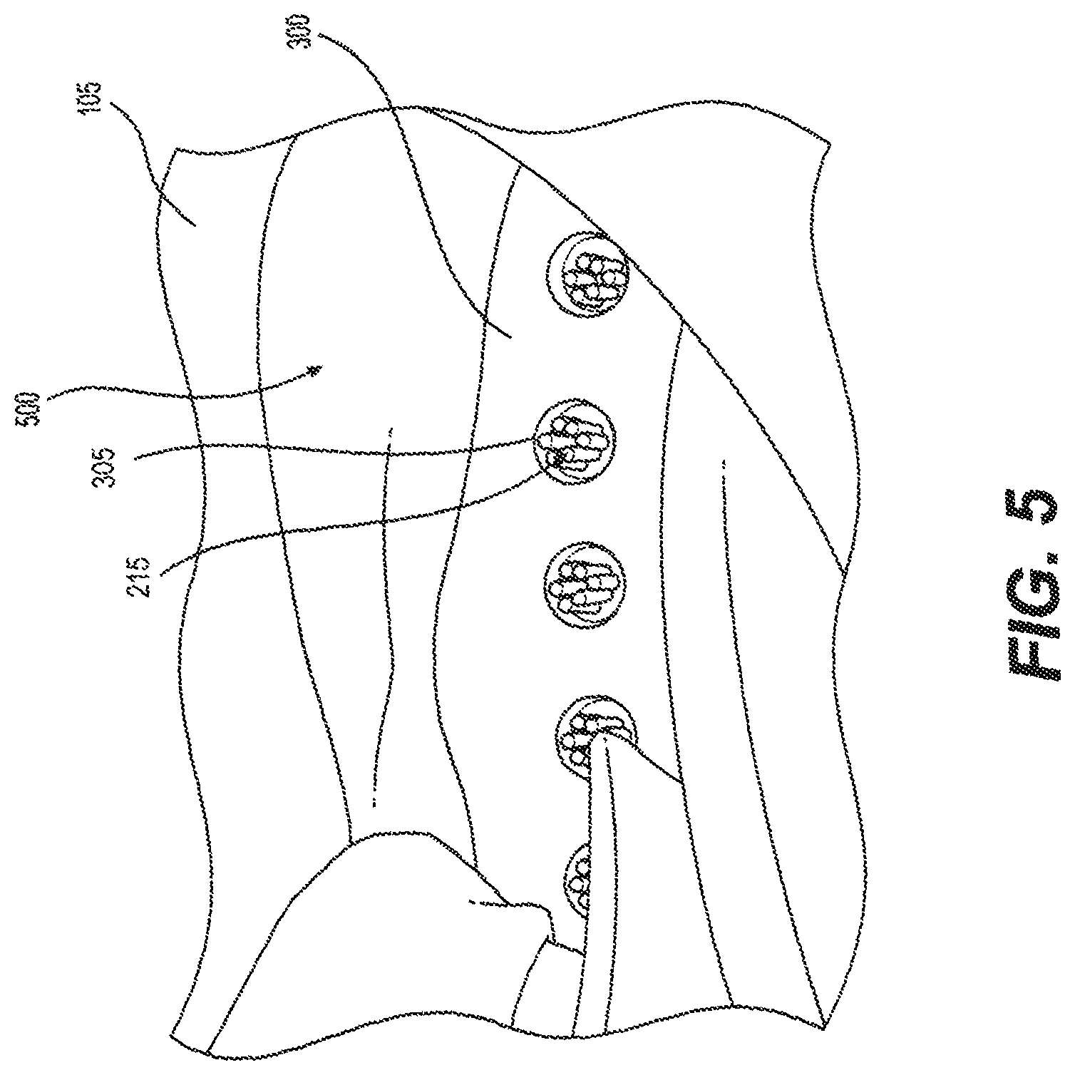 Patent US11812823 Figure 5 – Footwear having sensory feedback outsole