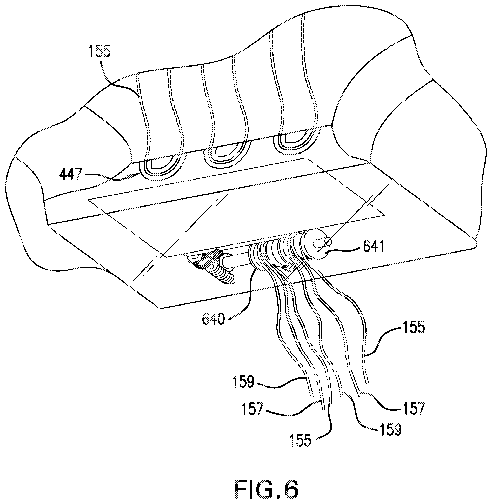 Patent US11812825 Figure 6 – Motorized tensioning device with compact spool system