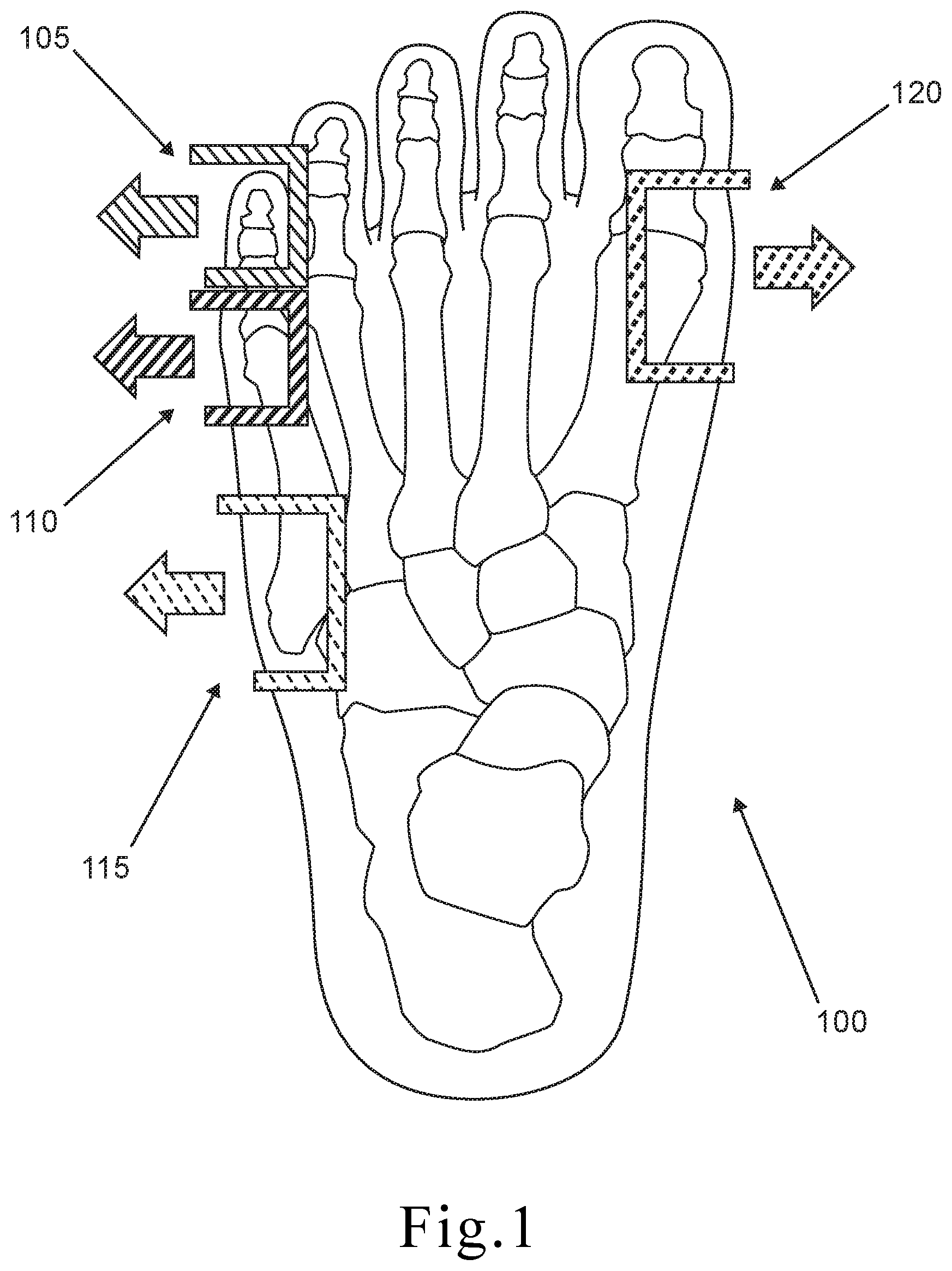 Patent US11812826 Figure 1 – Shoe fit measuring device