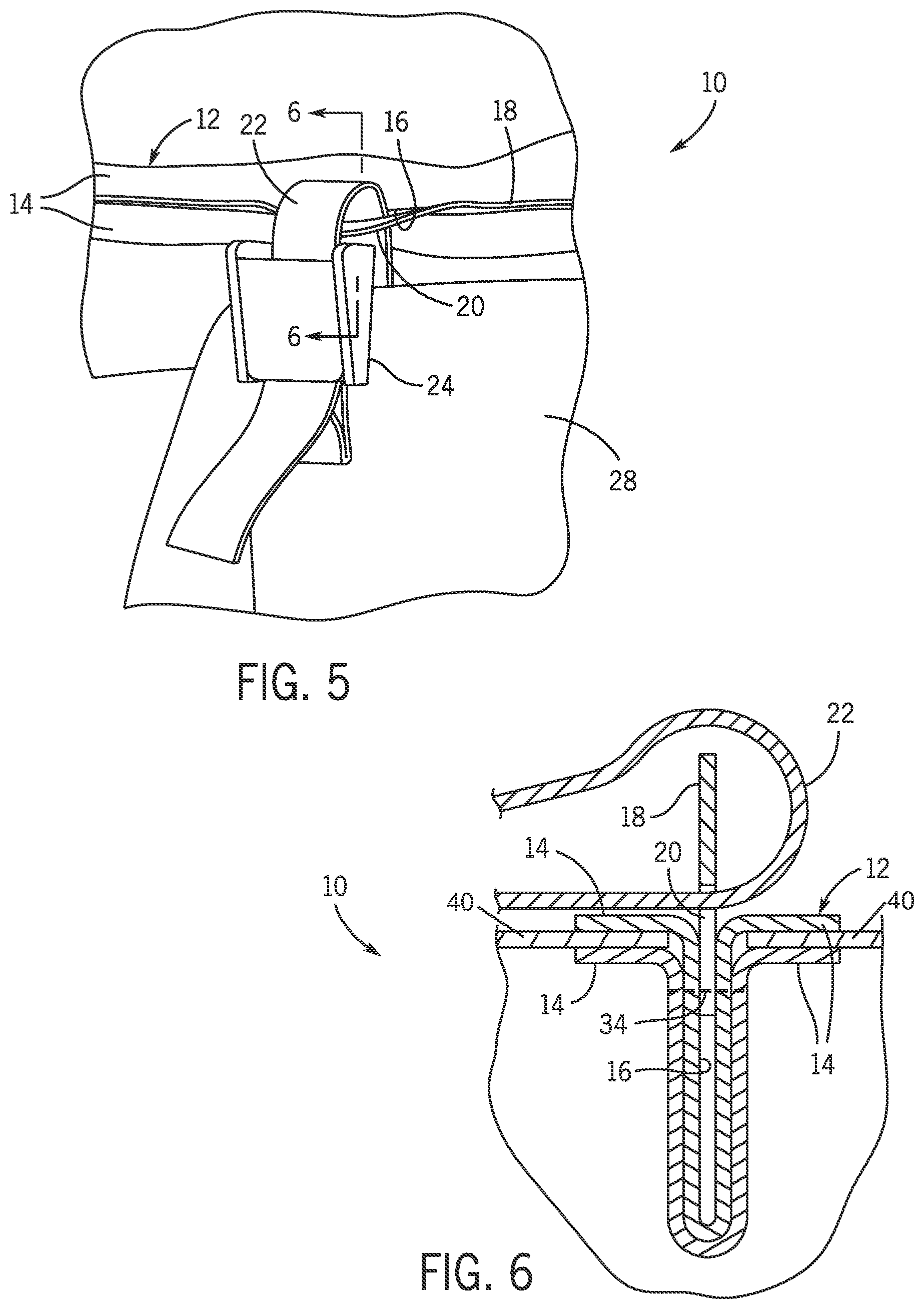 Patent US11812832 Figure 4 – Attachment system
