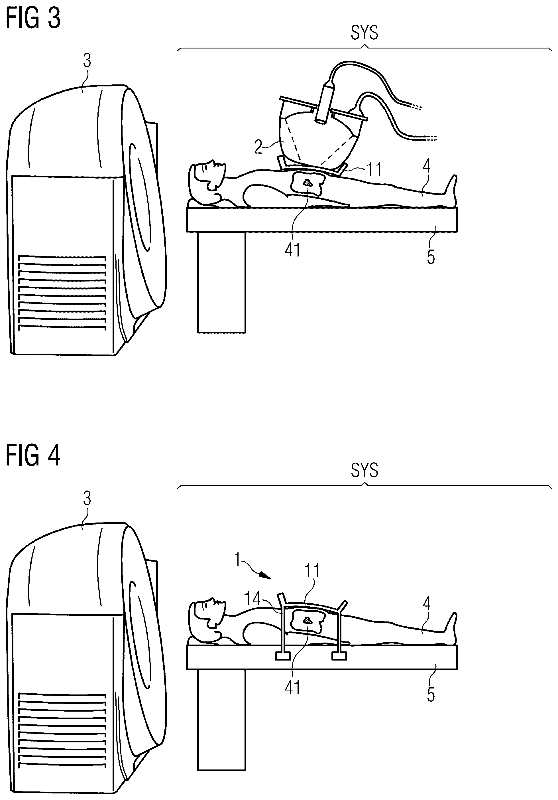 Patent US11812919 Figure 2 – Pressure control system for providing a pressure to be applied to a patient during a pre-interventional imaging process with an imaging system