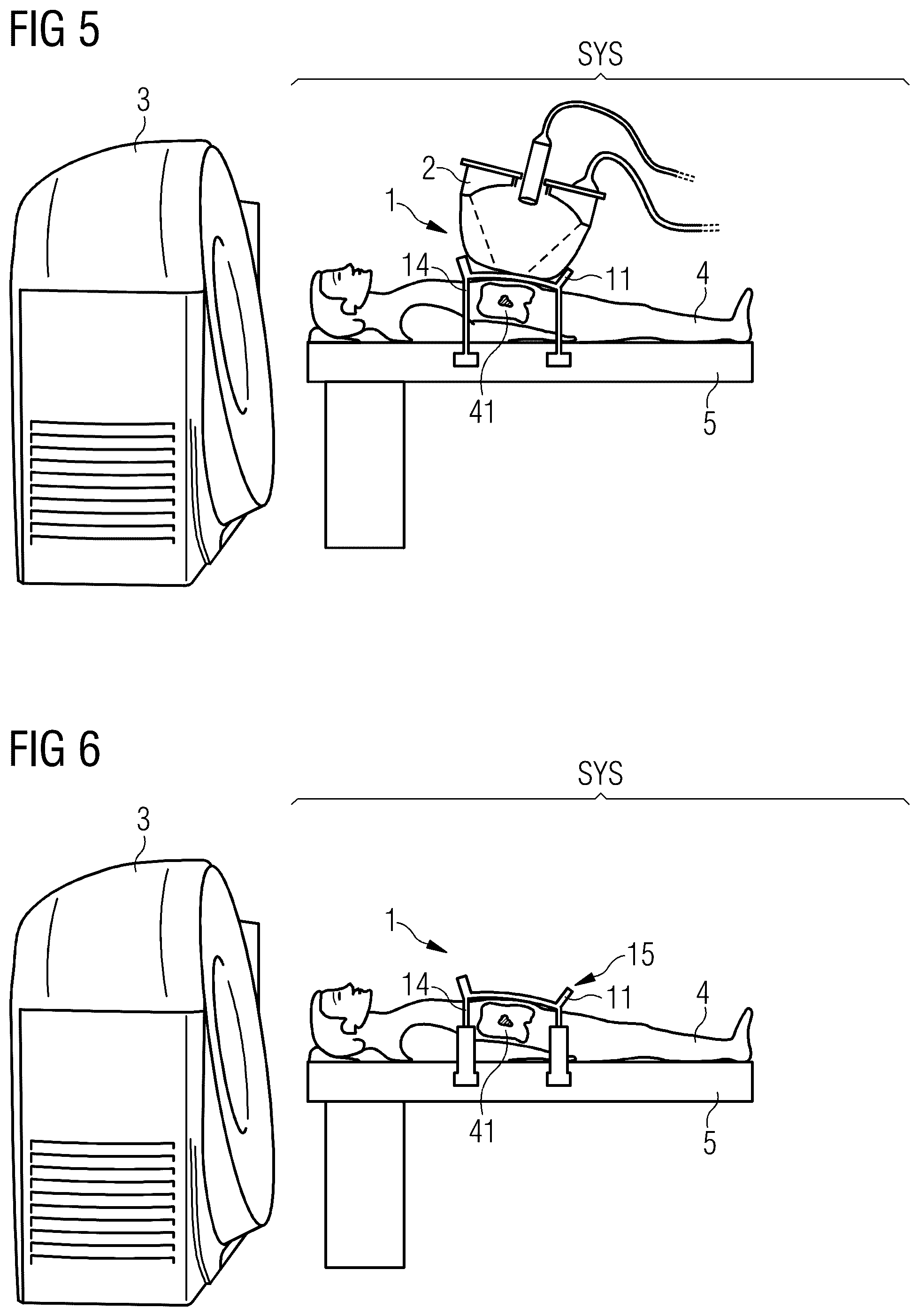 Patent US11812919 Figure 3 – Pressure control system for providing a pressure to be applied to a patient during a pre-interventional imaging process with an imaging system