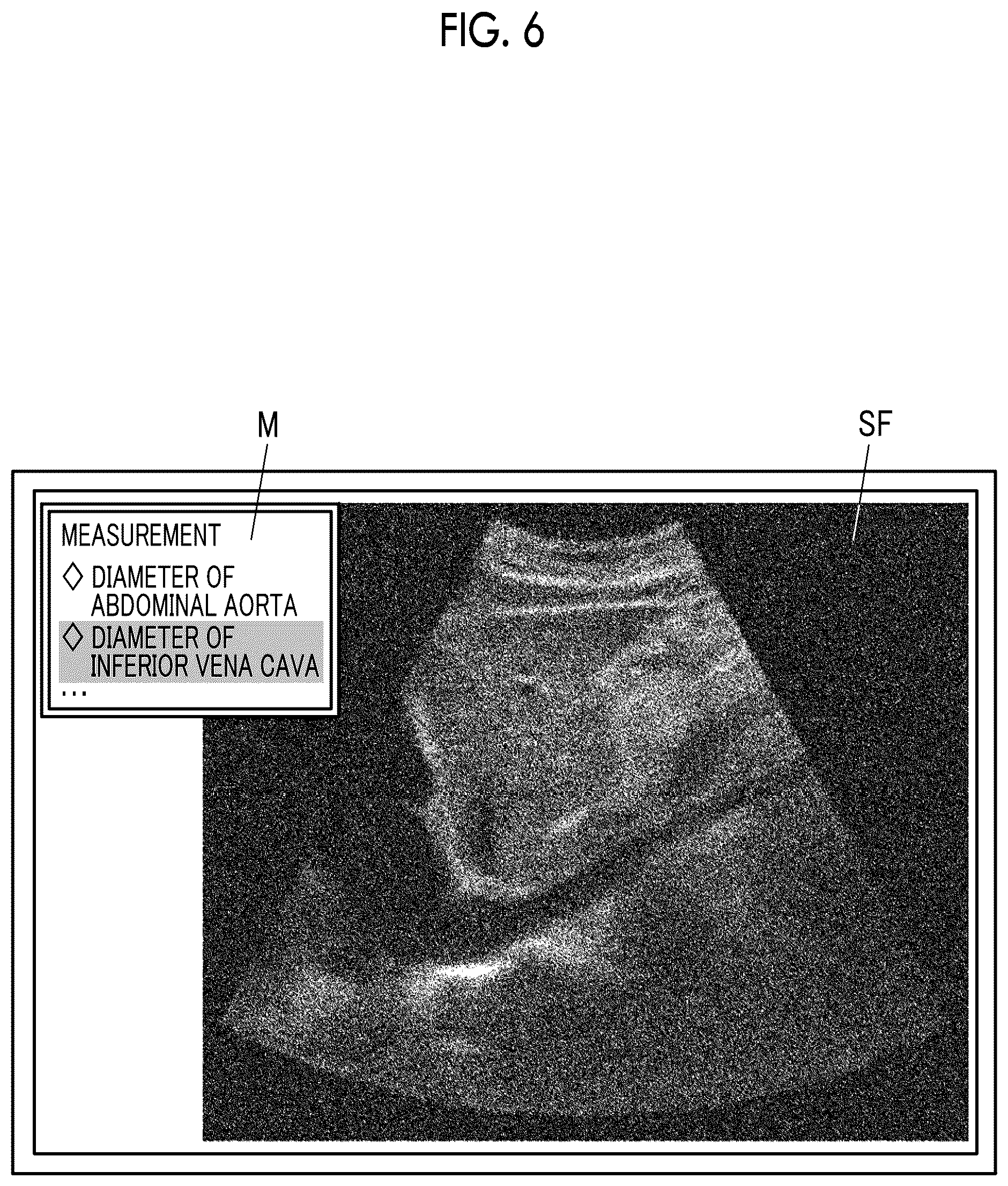 Patent US11812920 Figure 4 – Ultrasound diagnostic apparatus and method for controlling ultrasound diagnostic apparatus