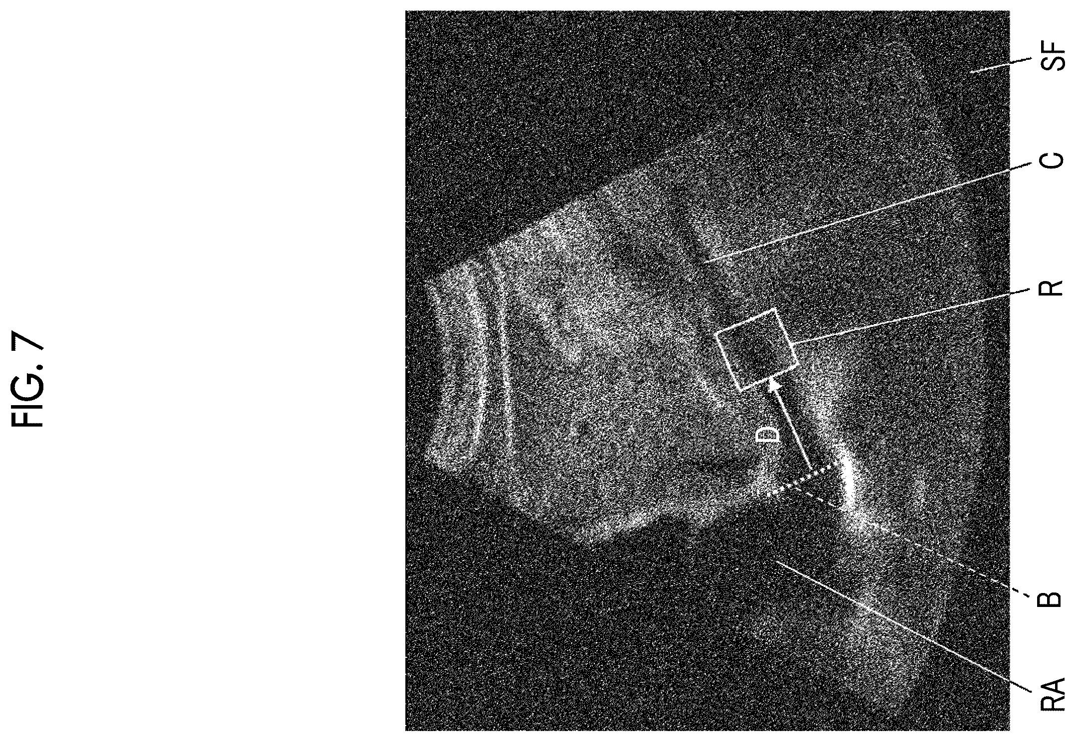 Patent US11812920 Figure 5 – Ultrasound diagnostic apparatus and method for controlling ultrasound diagnostic apparatus