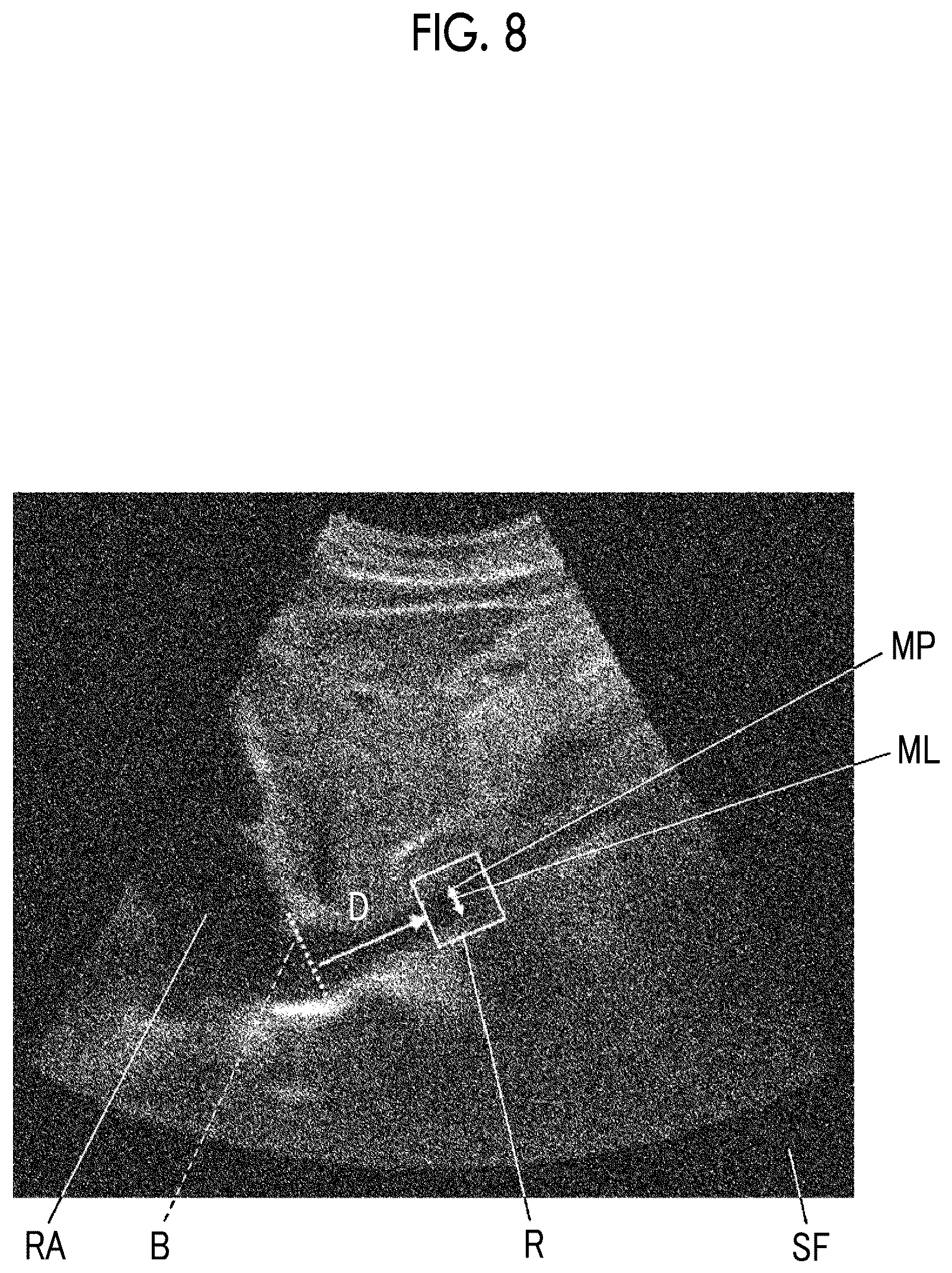 Patent US11812920 Figure 6 – Ultrasound diagnostic apparatus and method for controlling ultrasound diagnostic apparatus