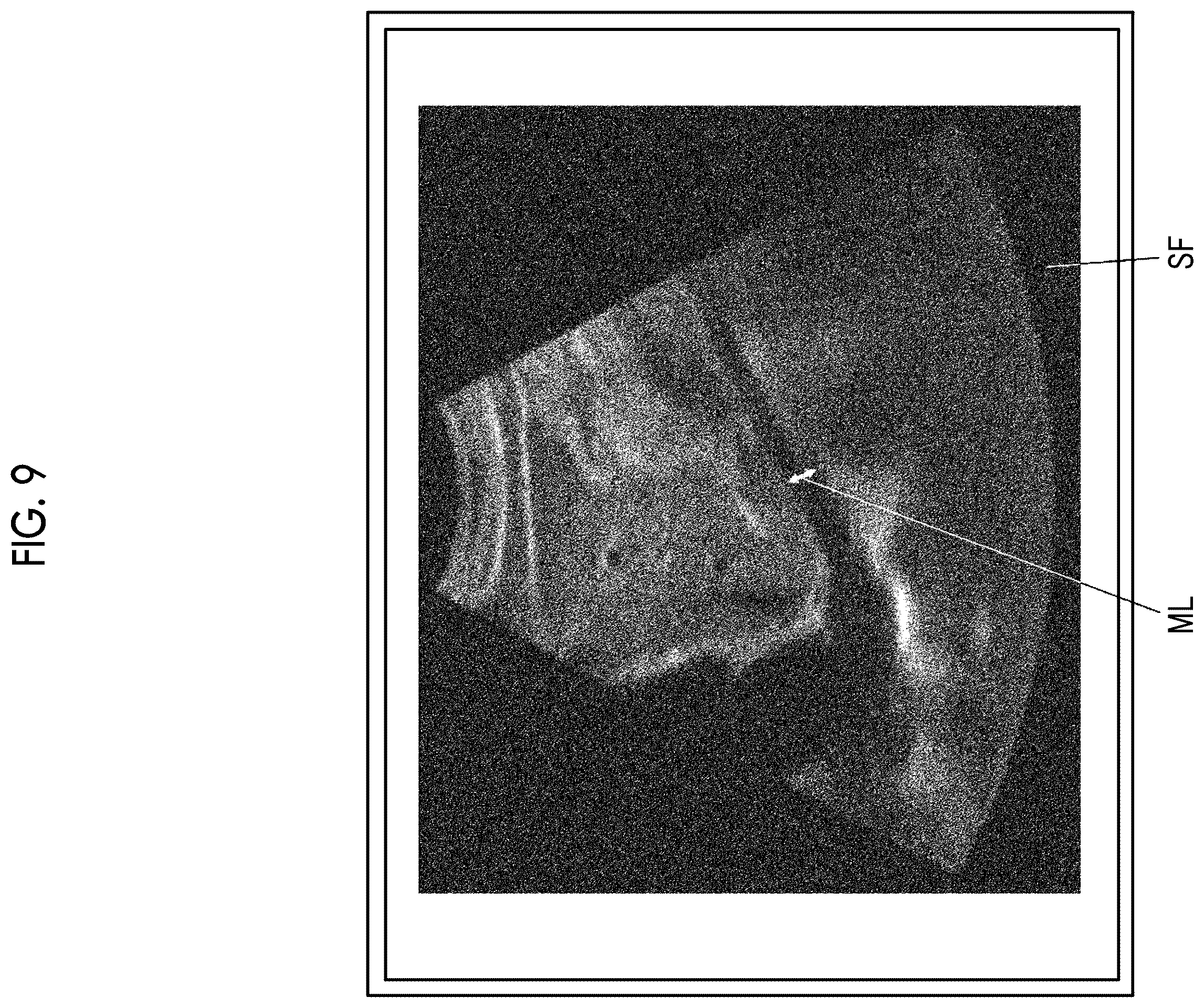 Patent US11812920 Figure 7 – Ultrasound diagnostic apparatus and method for controlling ultrasound diagnostic apparatus