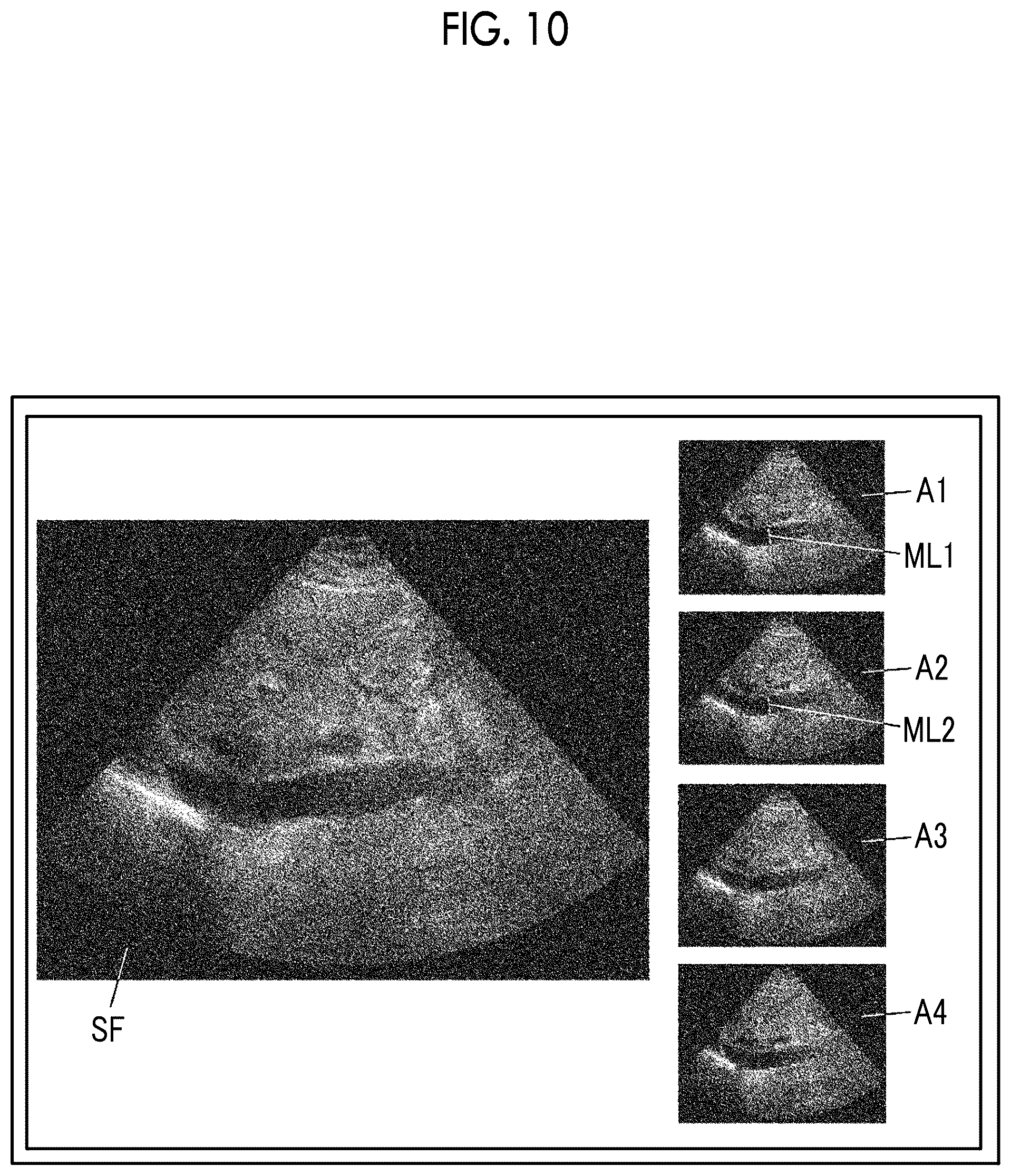 Patent US11812920 Figure 8 – Ultrasound diagnostic apparatus and method for controlling ultrasound diagnostic apparatus
