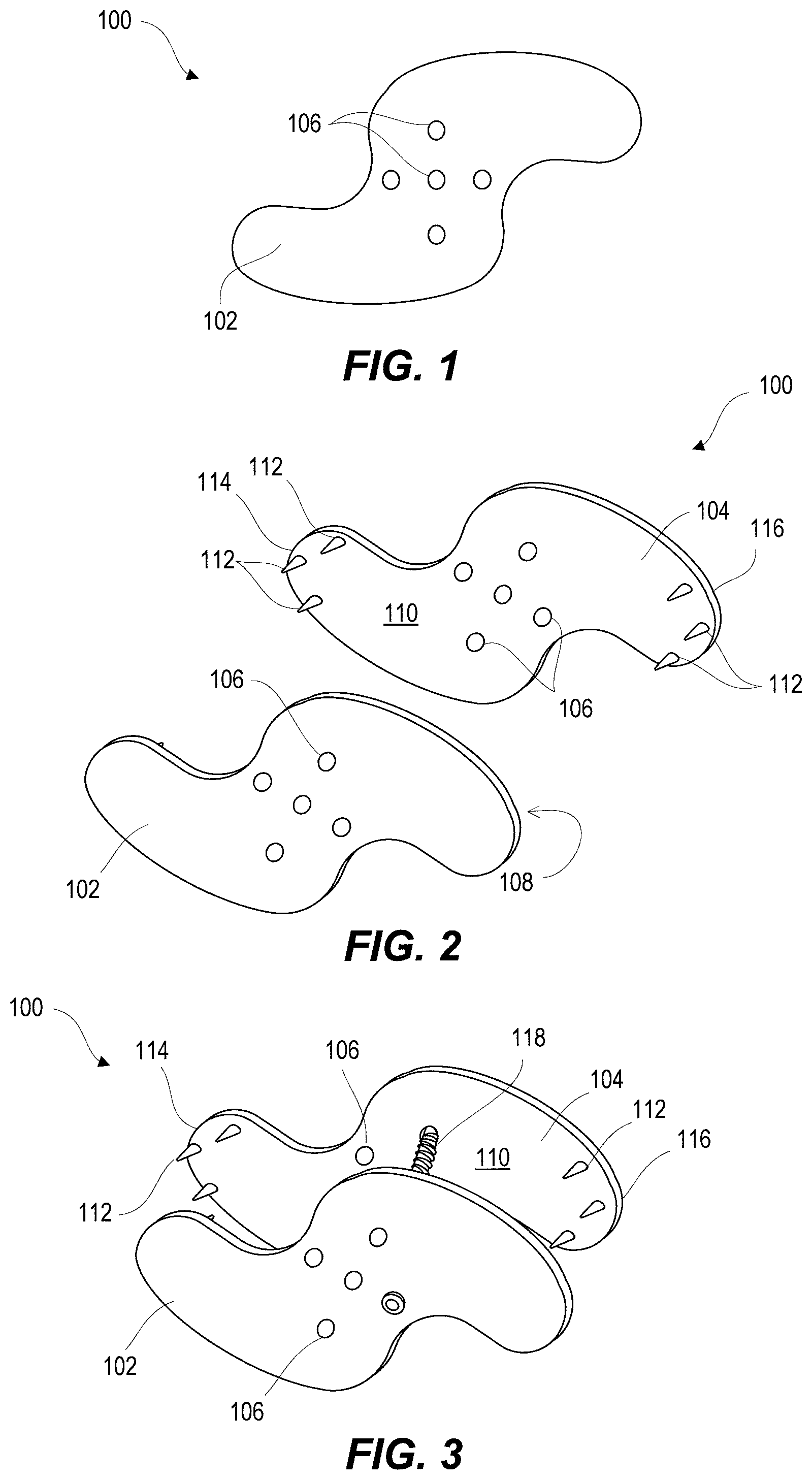 Patent US11812923 Figure 1 – Spinal fixation device