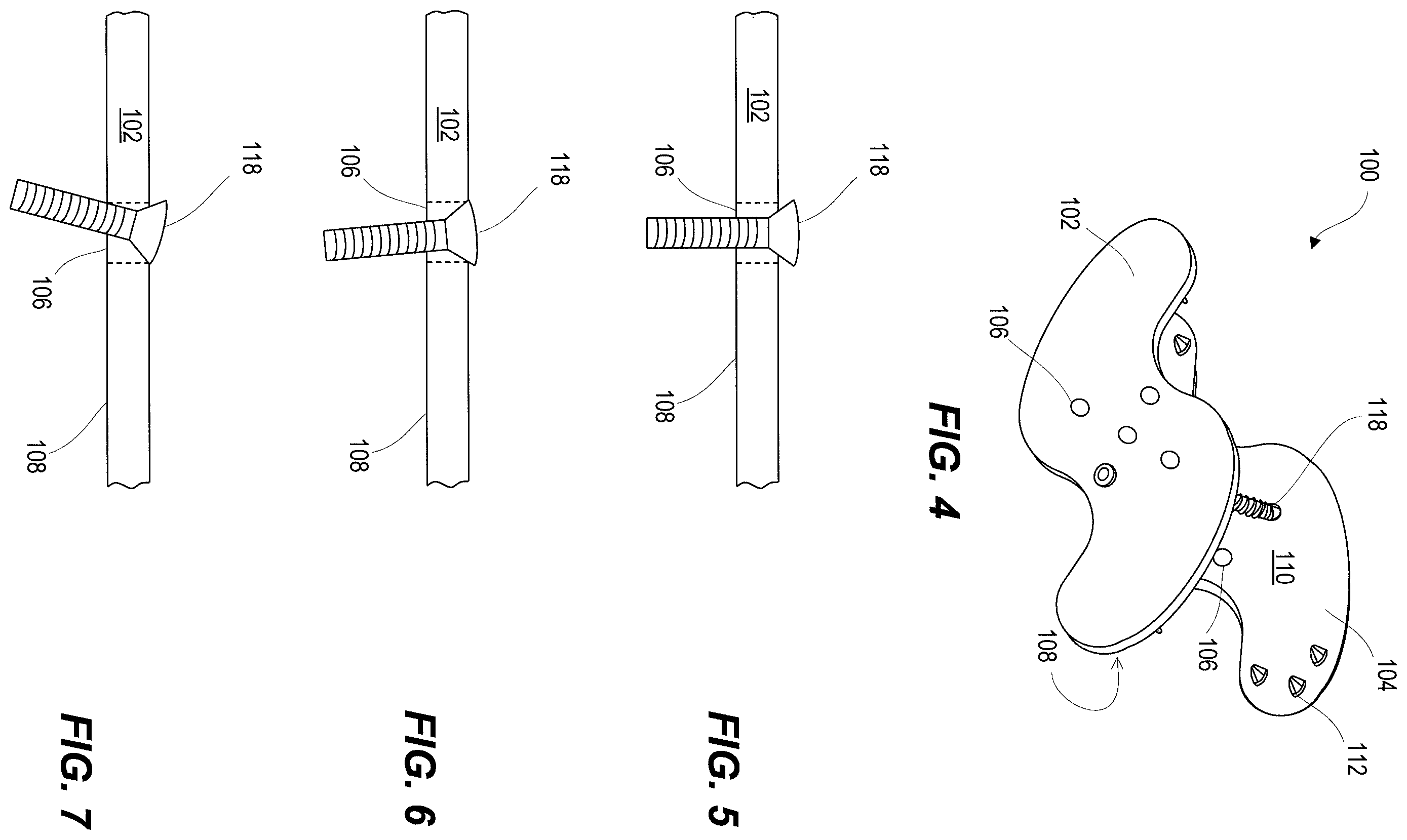 Patent US11812923 Figure 2 – Spinal fixation device