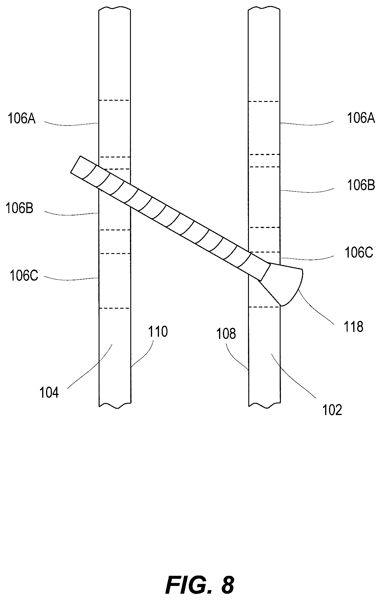Patent US11812923 Figure 3 – Spinal fixation device