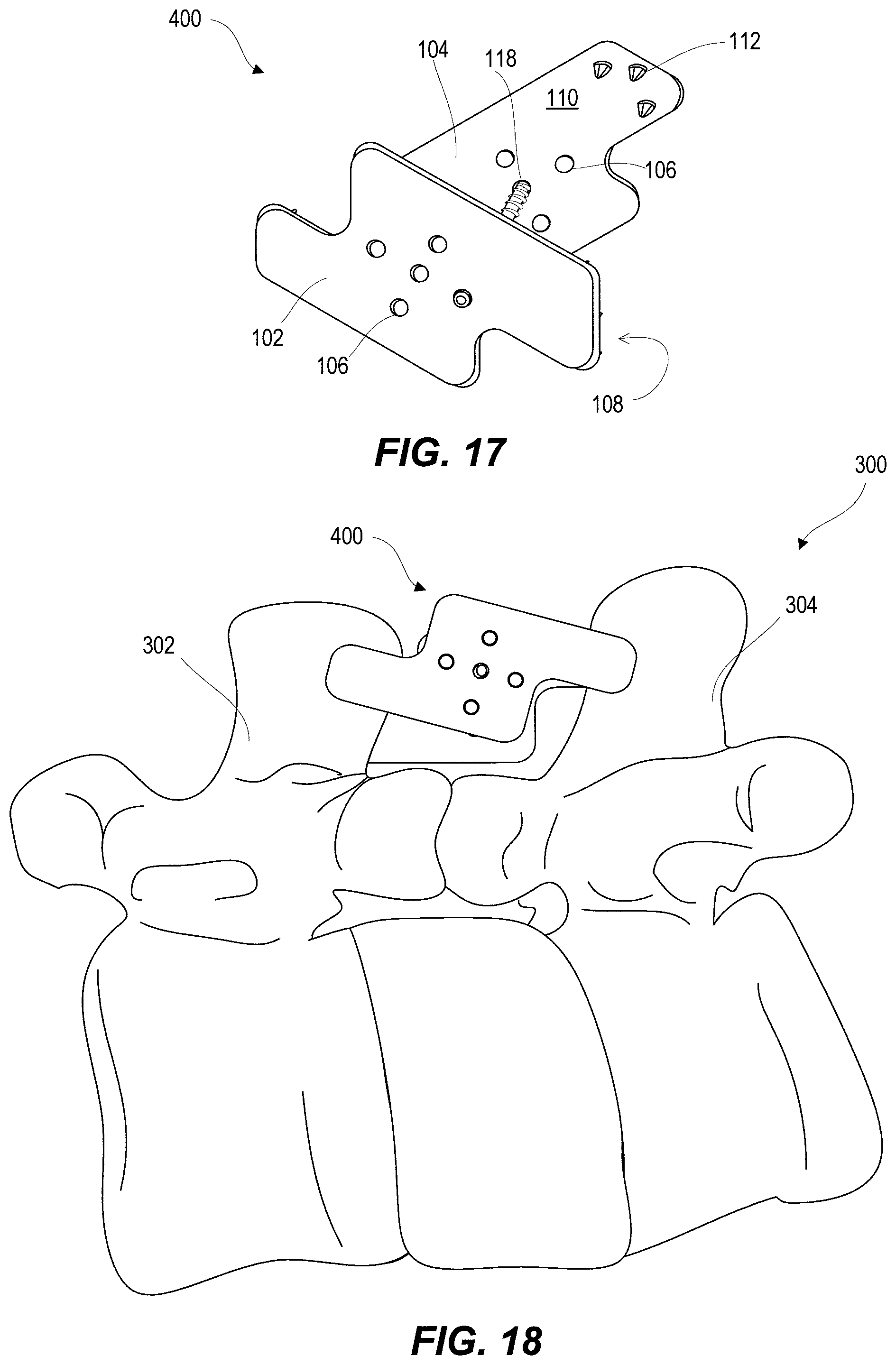 Patent US11812923 Figure 8 – Spinal fixation device